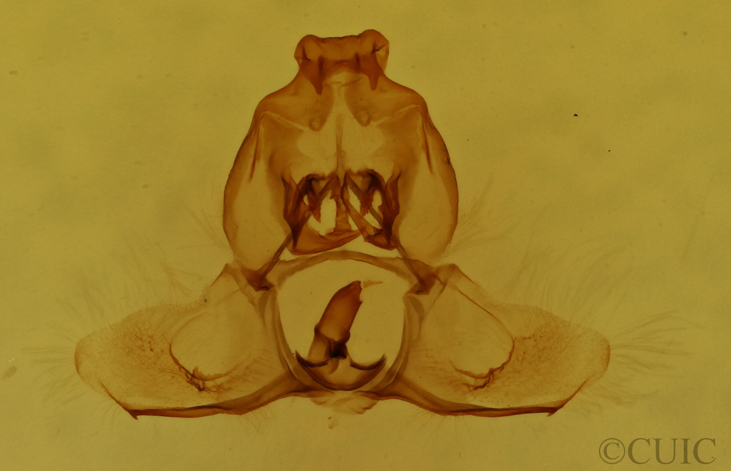 genitalia view of adult Xenotemna pallorana