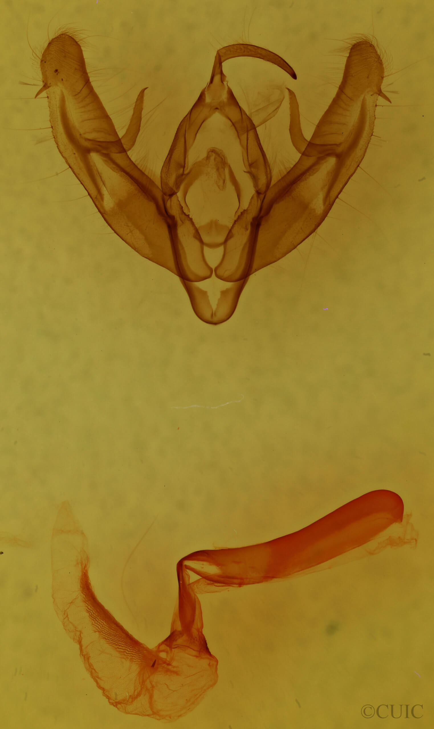 genitalia view of adult Xestia