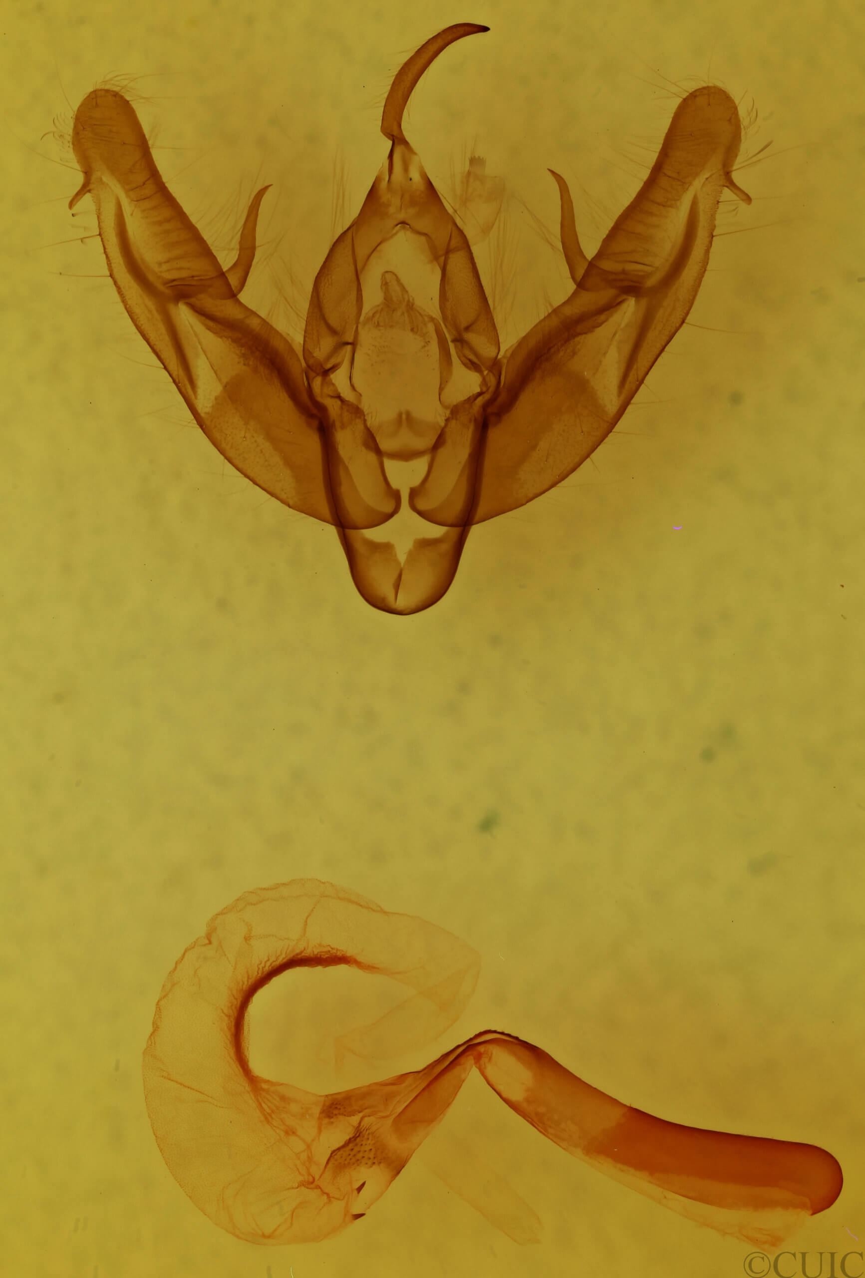 genitalia view of adult Xestia
