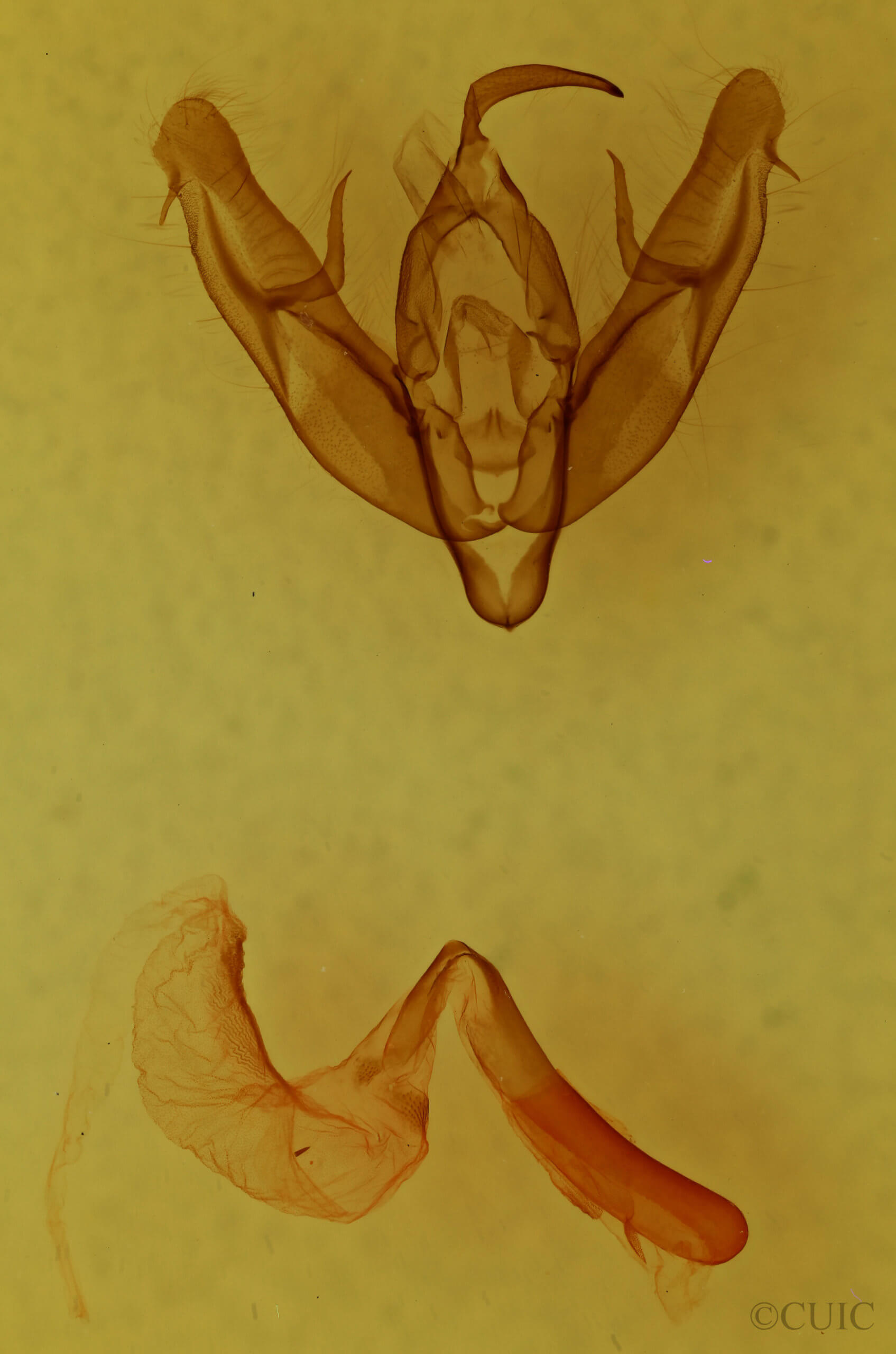 genitalia view of adult Xestia