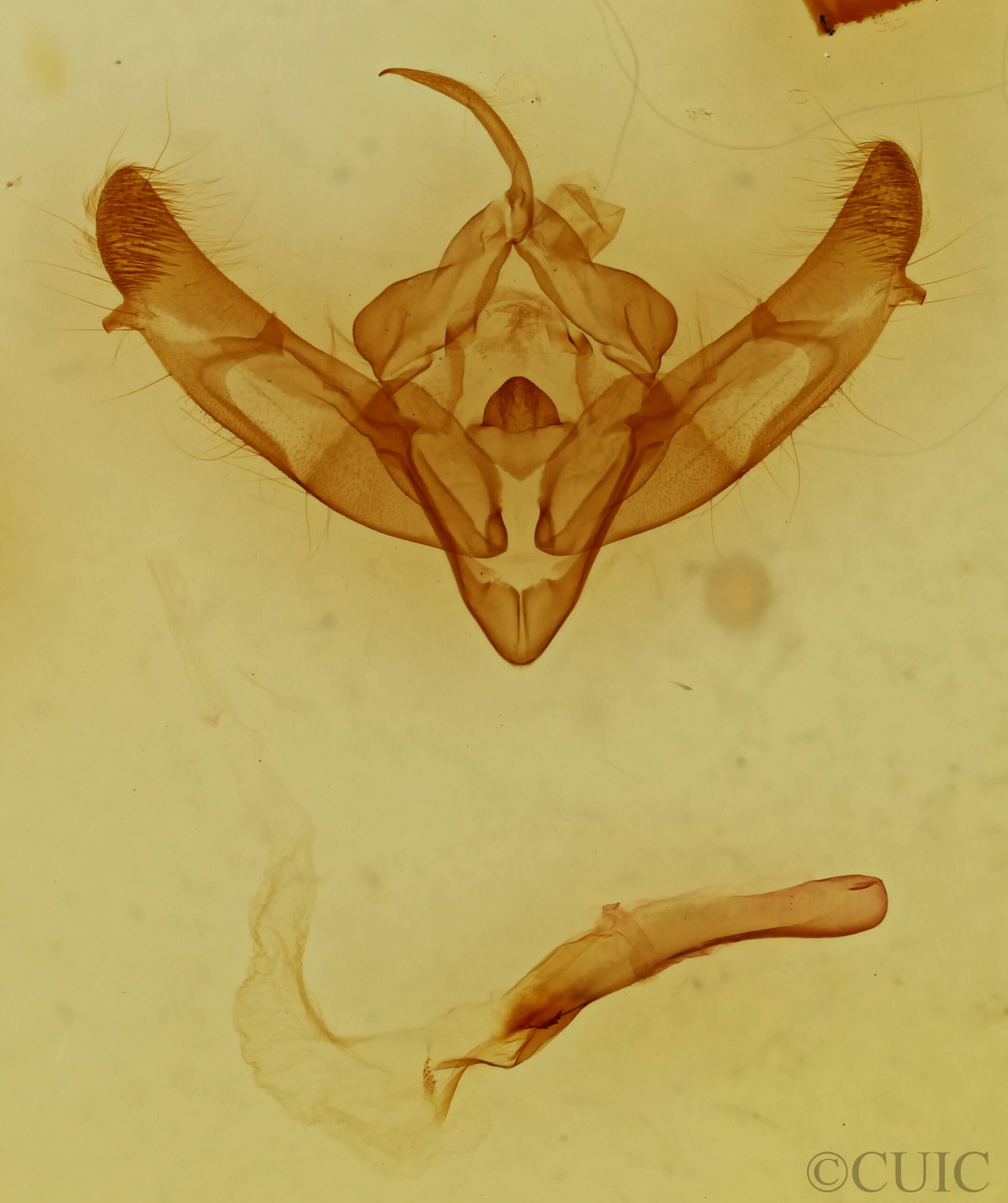 genitalia view of adult Xestia dolosa