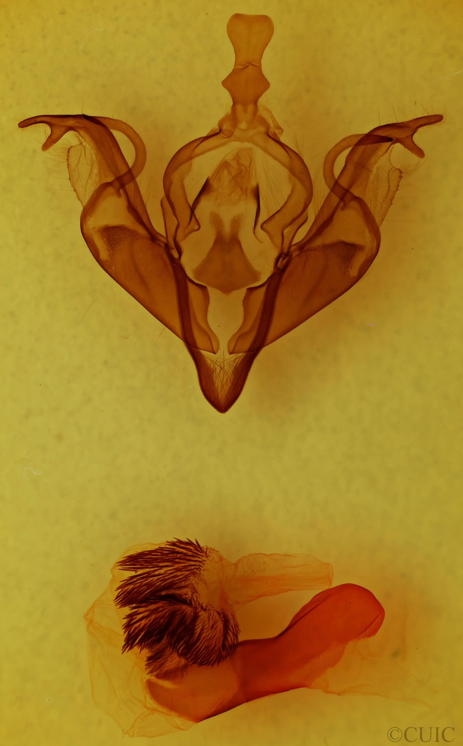 genitalia view of adult Xylena cineritia