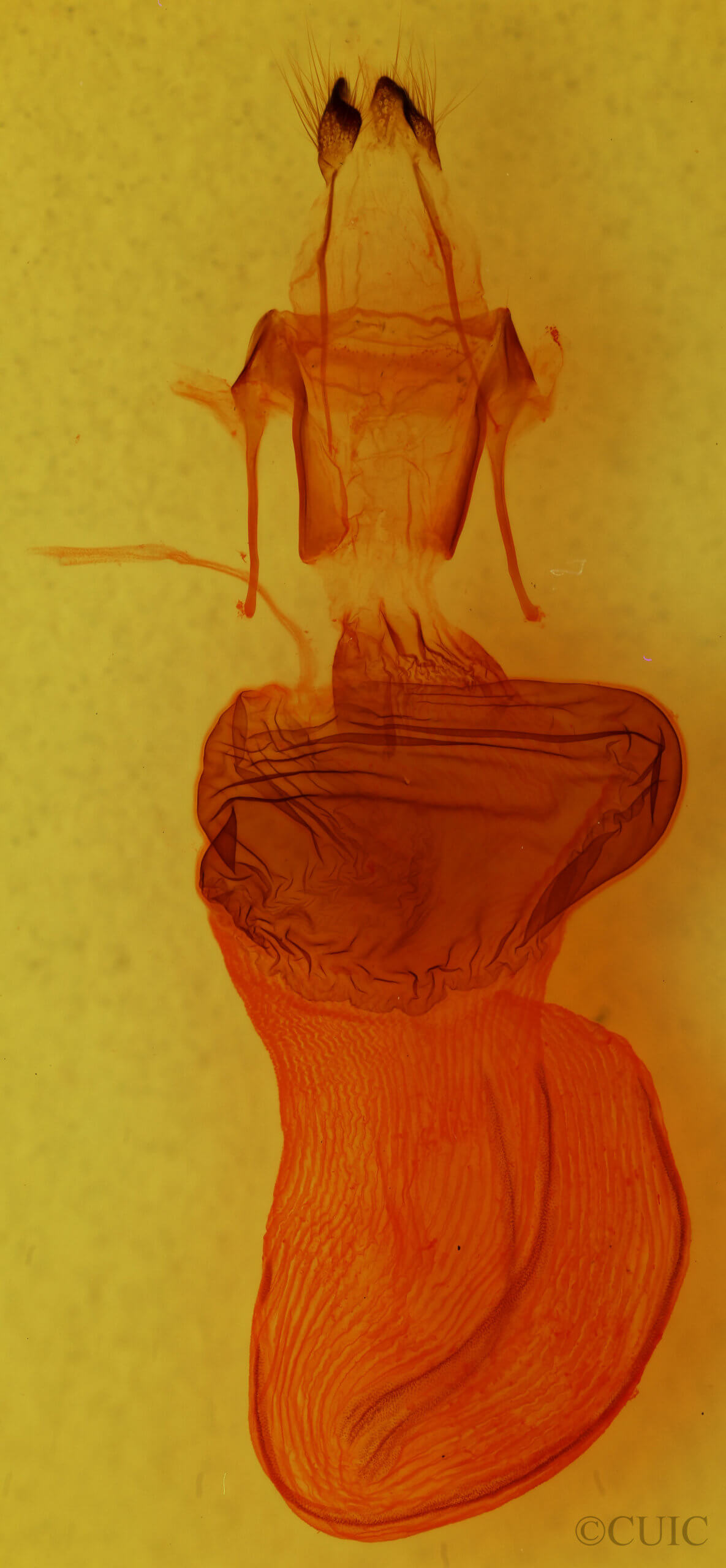 genitalia view of adult Xylena cineritia