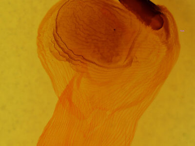 genitalia view of adult Xylena nupera