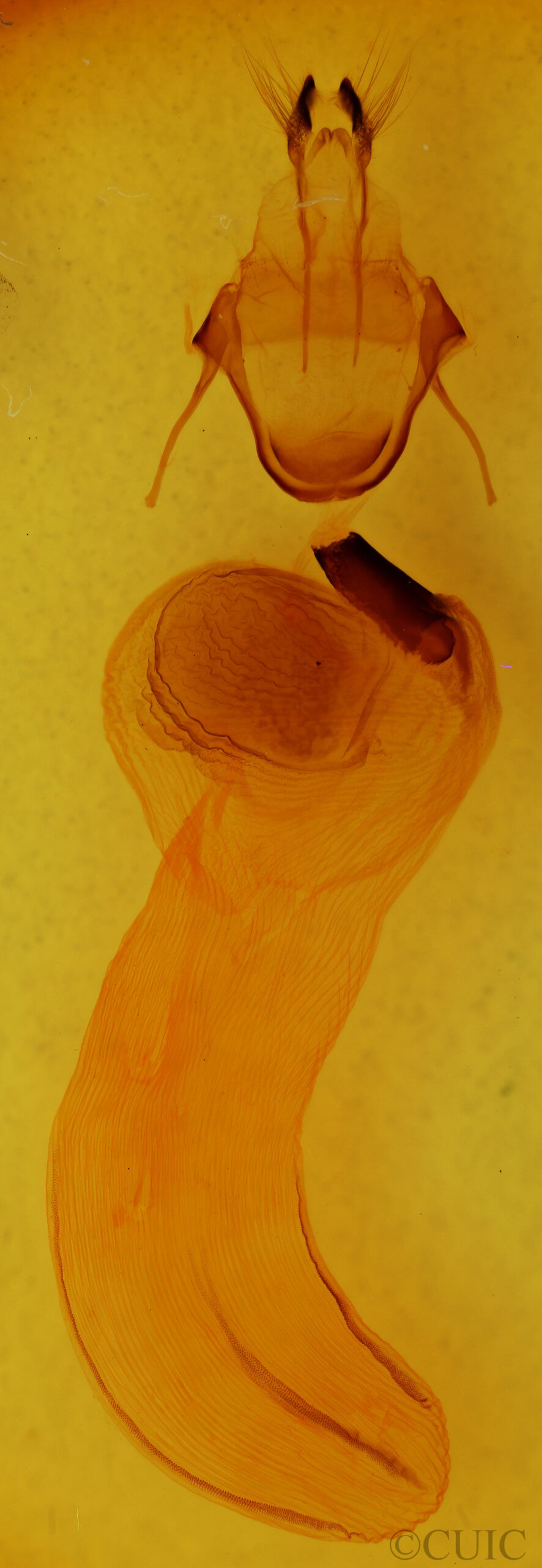 genitalia view of adult Xylena nupera