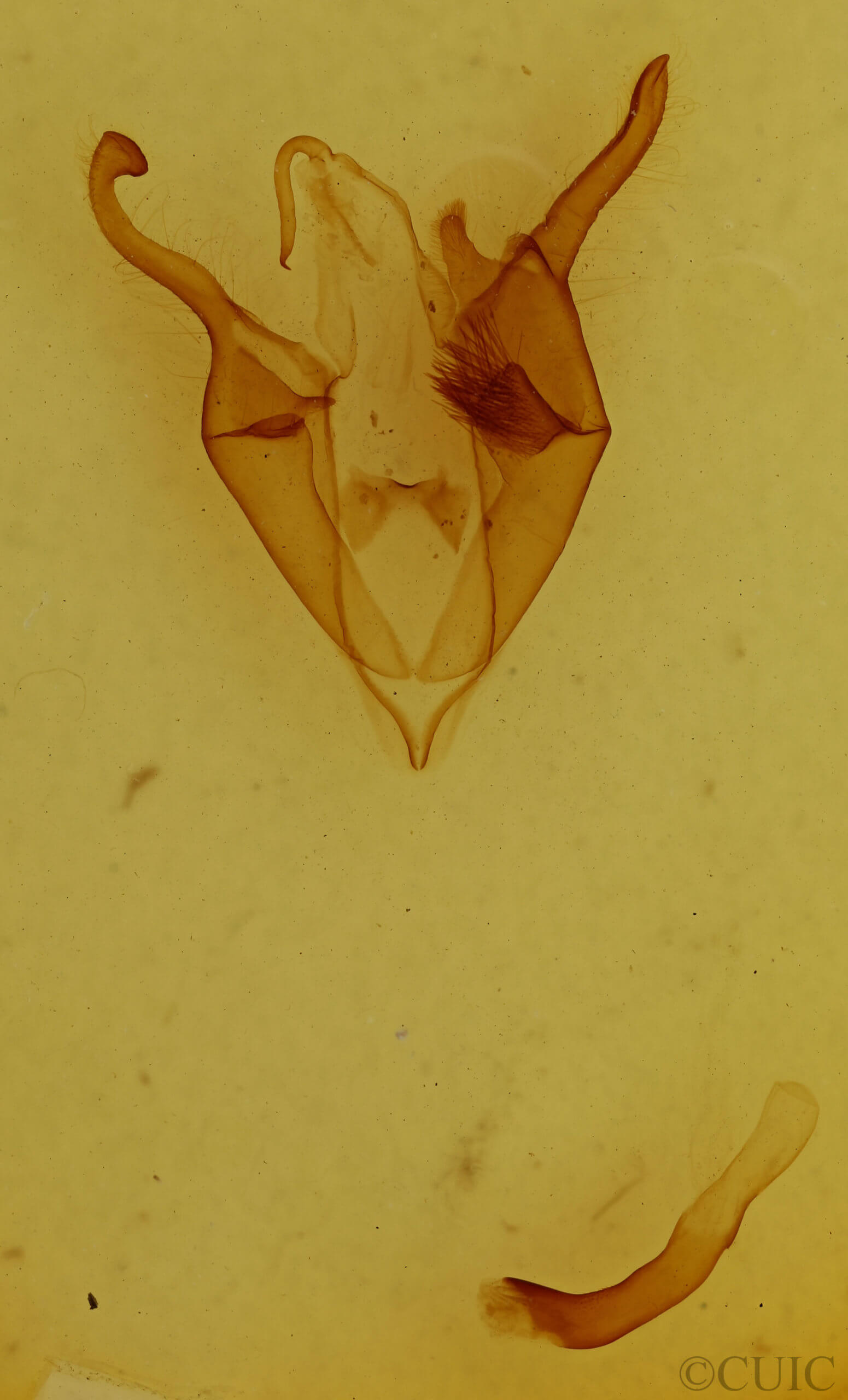 genitalia view of adult Zale metatoides