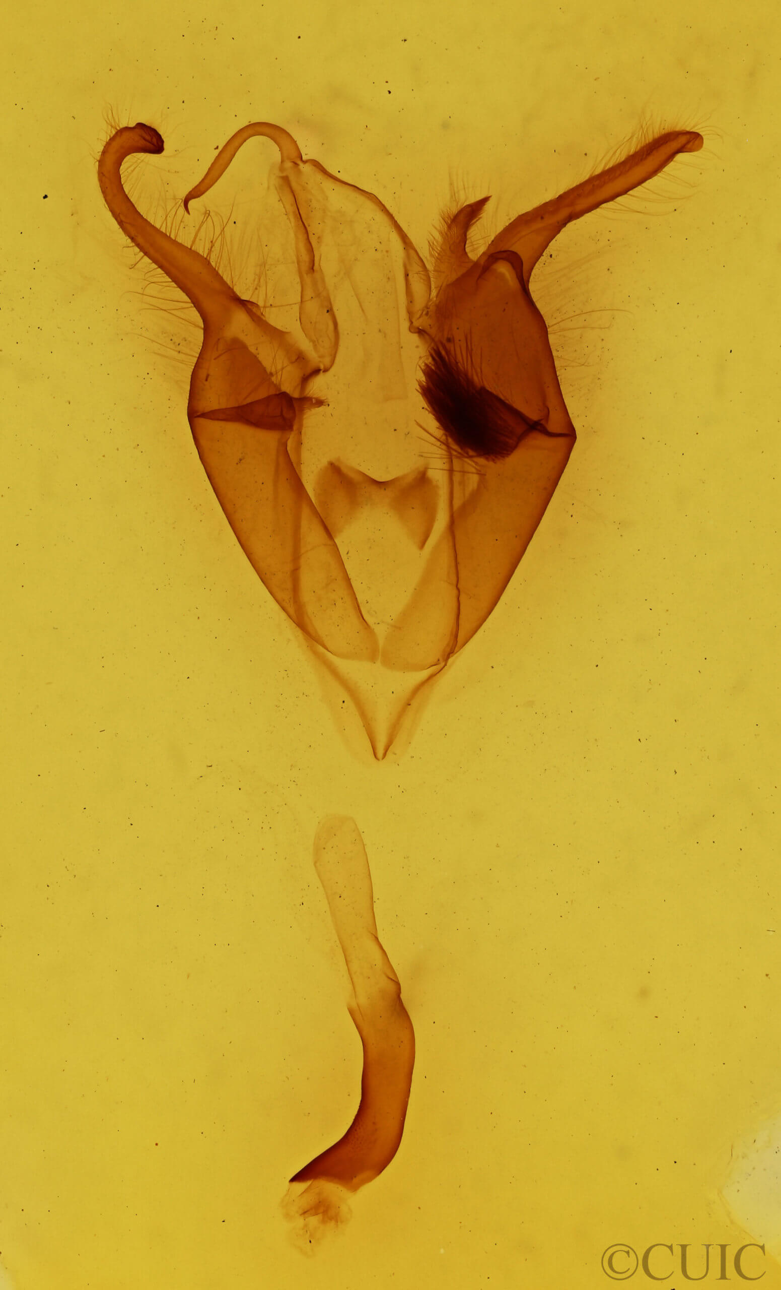 genitalia view of adult Zale metatoides