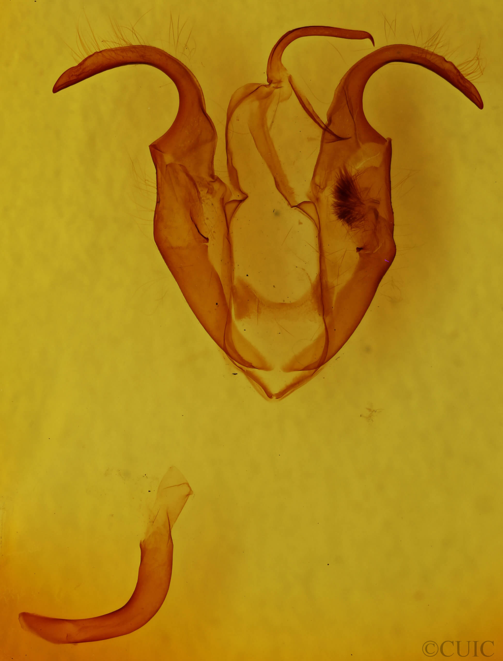 genitalia view of adult Zale perculta