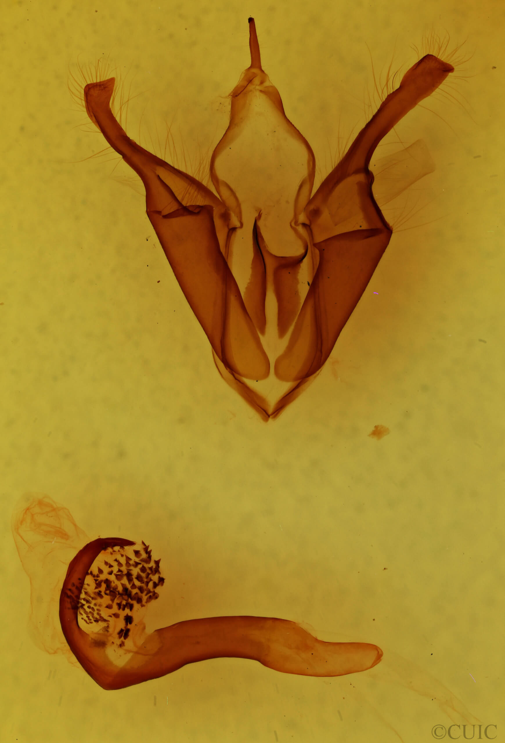 genitalia view of adult Zale phaeocapna