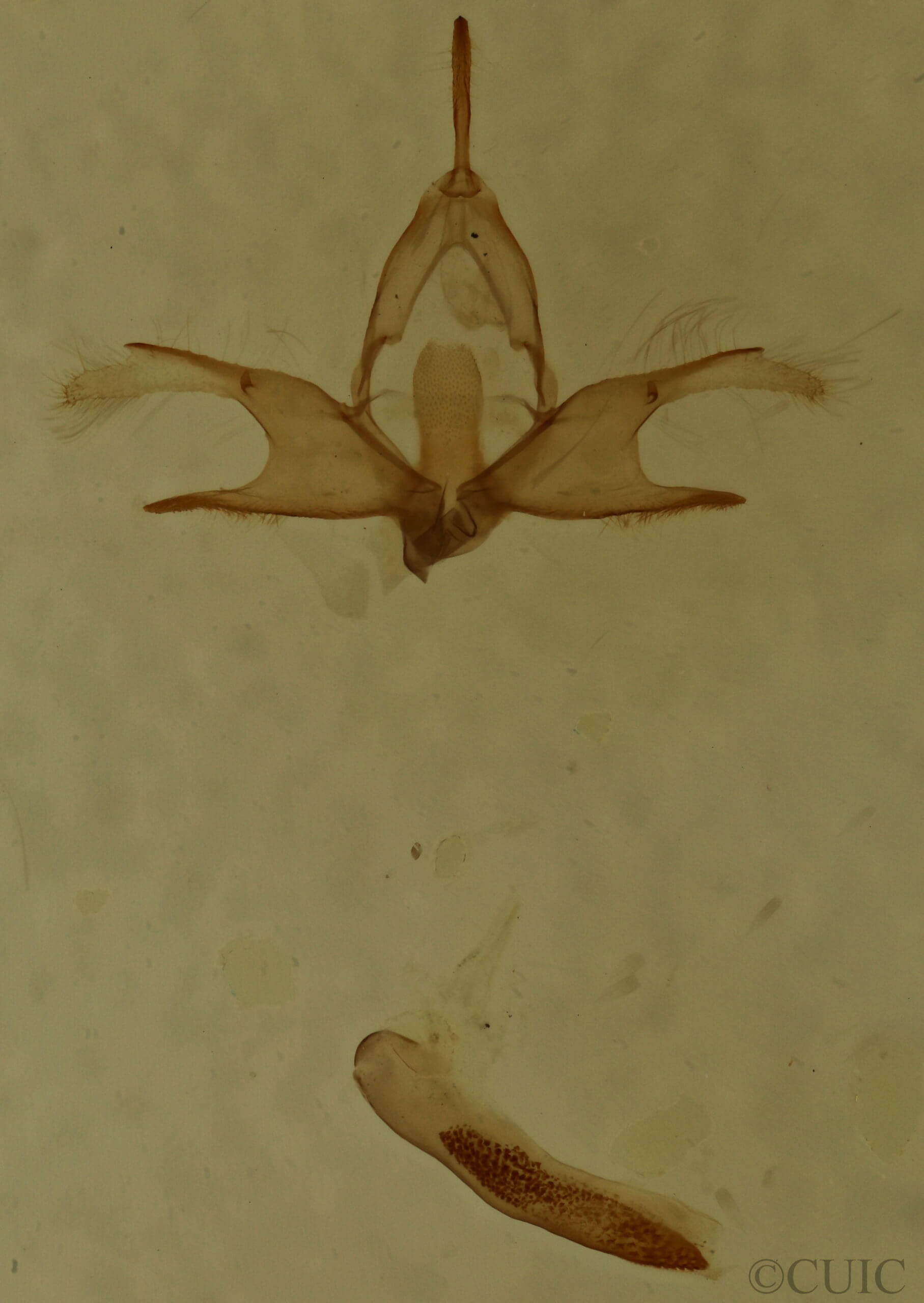 genitalia view of adult Zanclognatha lituralis