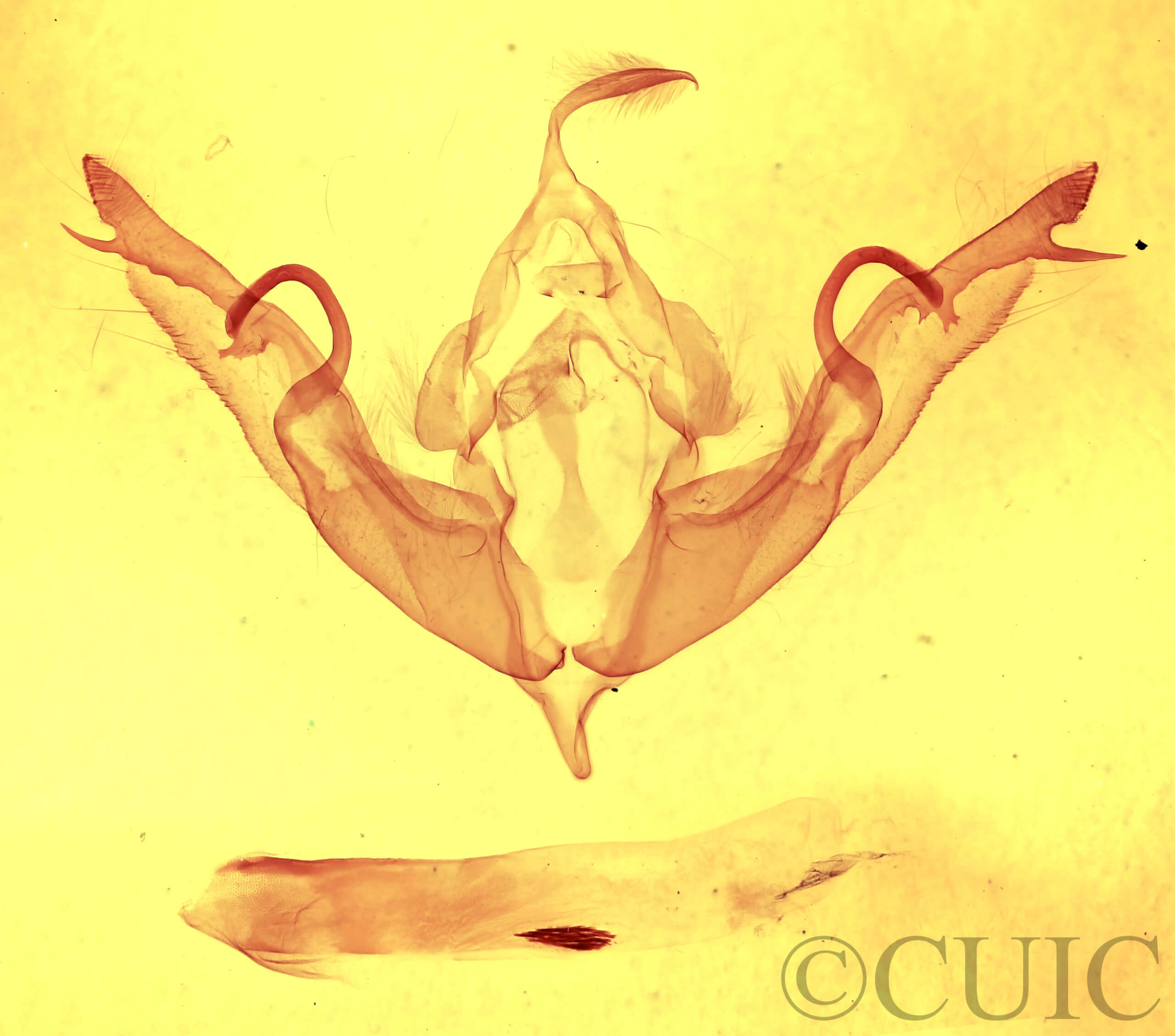 genitalia view of adult Lithophane petulca