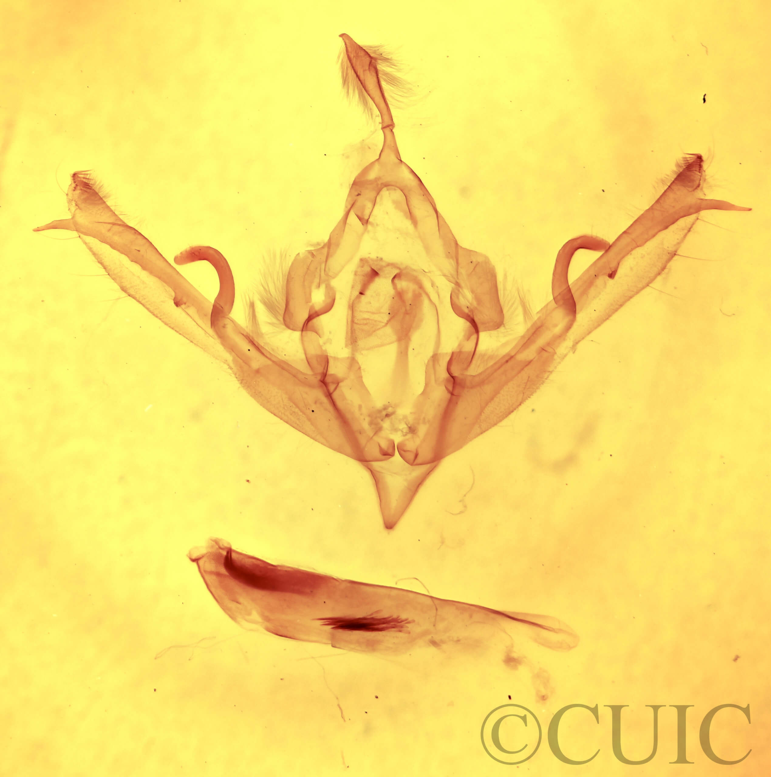 genitalia view of adult Lithophane signosa