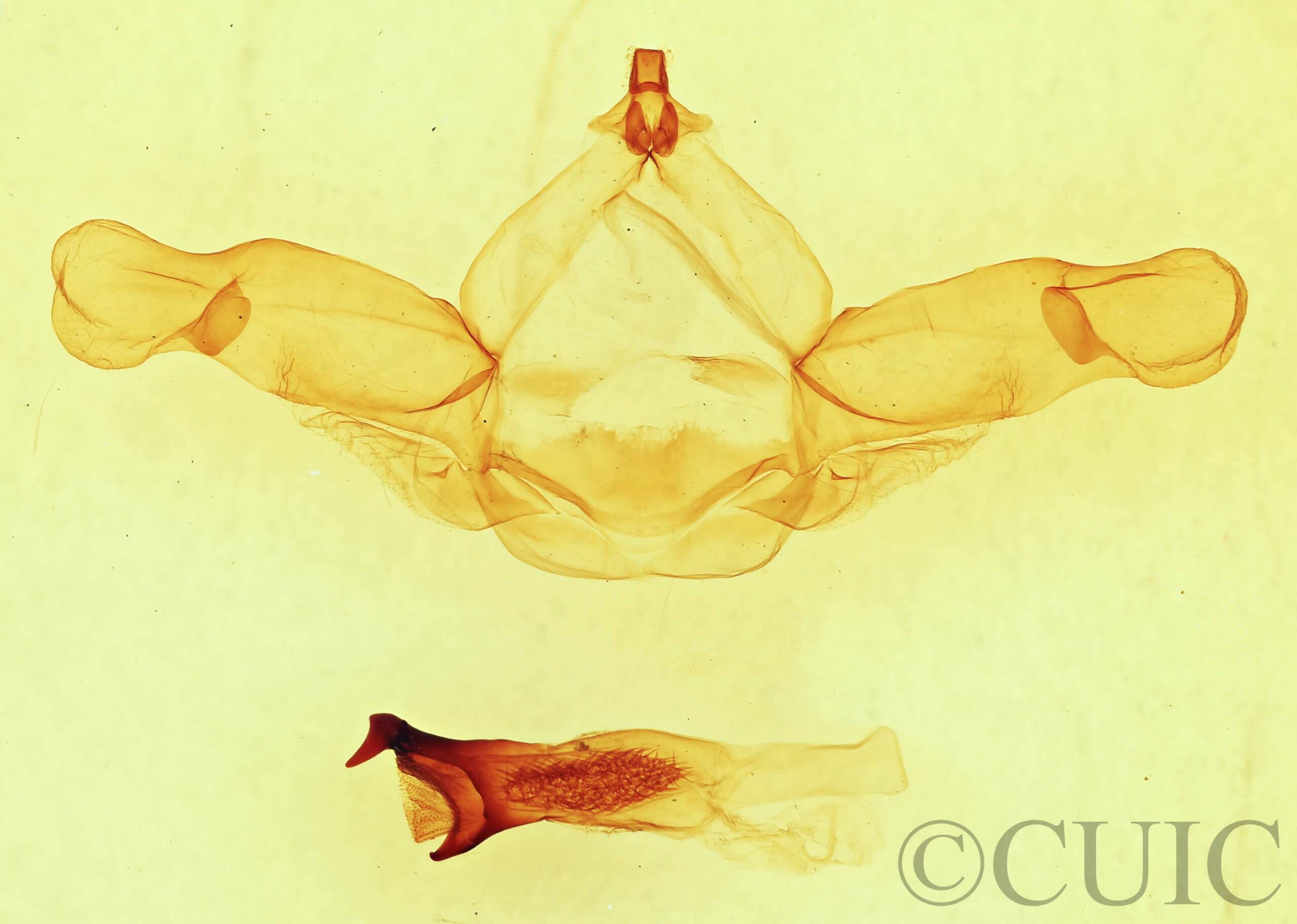 genitalia view of adult Nadata gibbosa