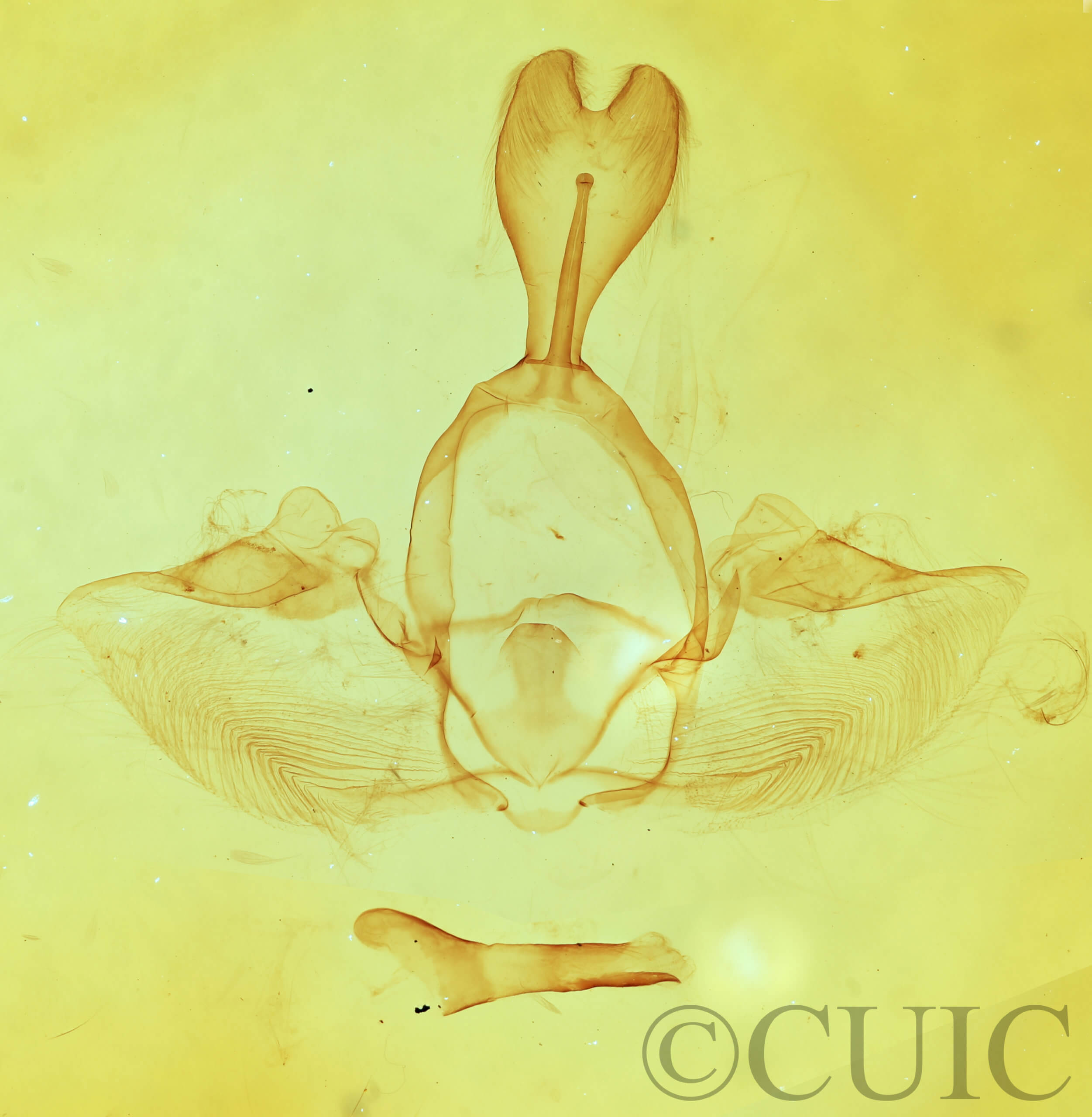 genitalia view of adult Gluphisia