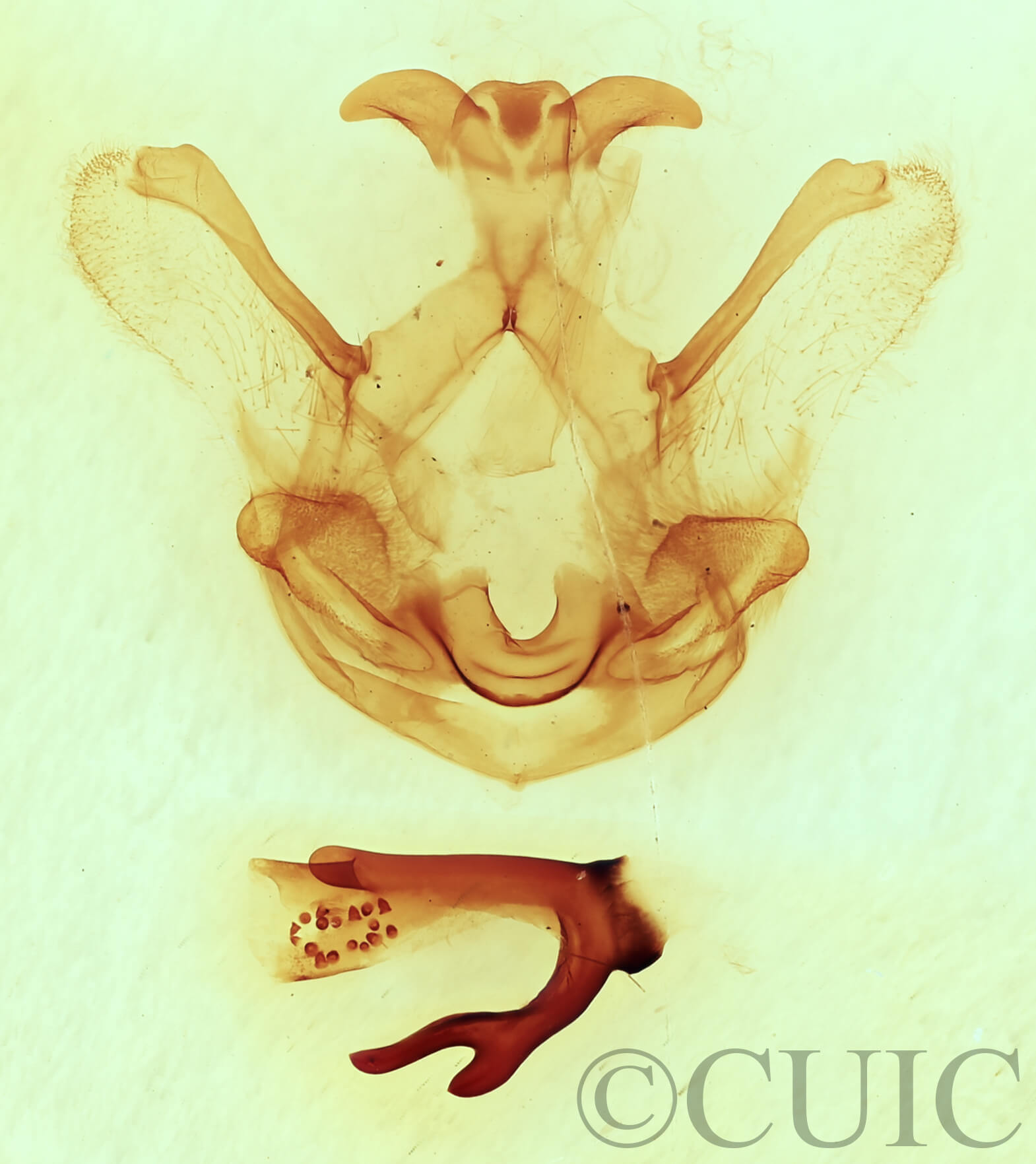 genitalia view of adult Symmerista leucitys