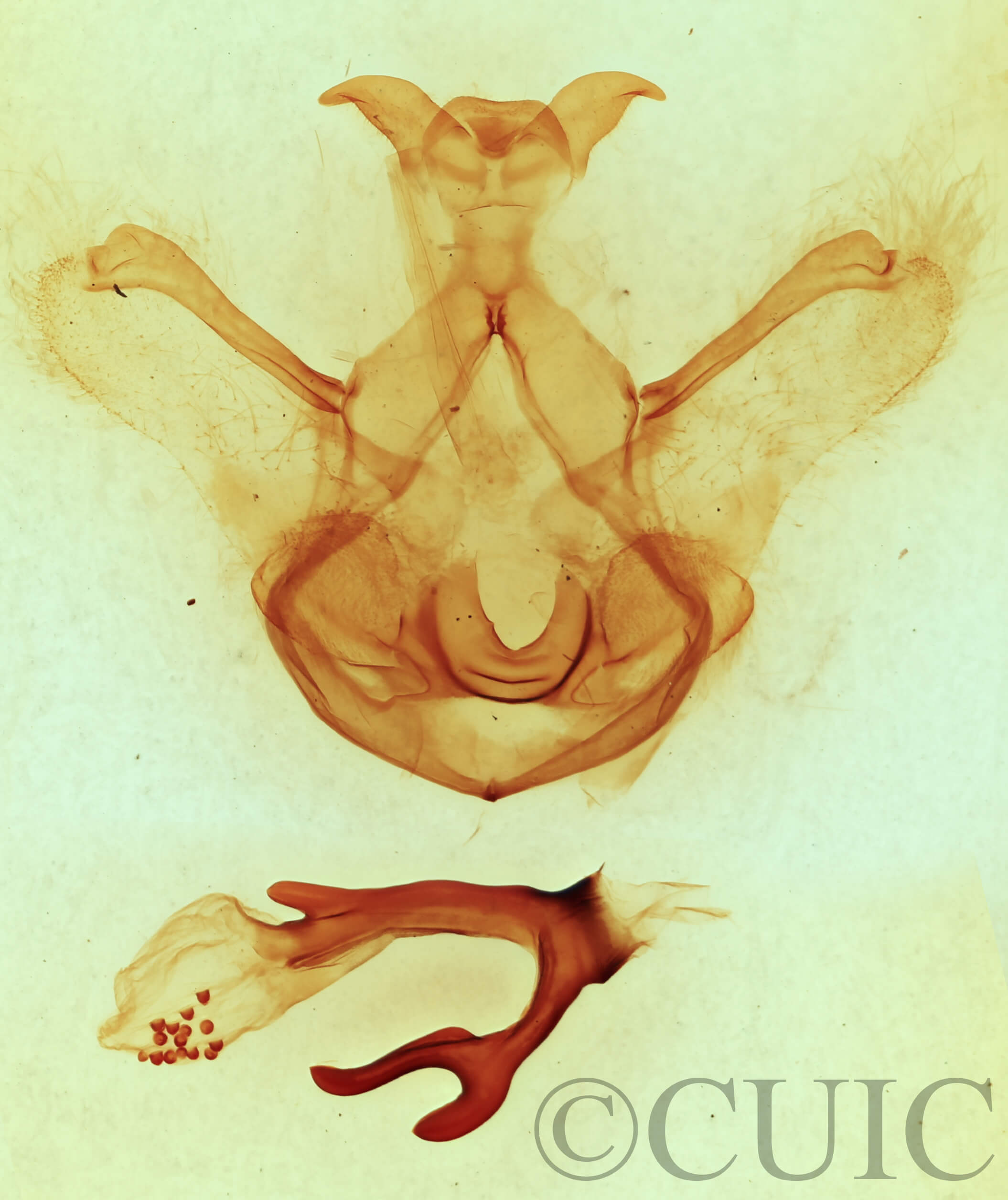 genitalia view of adult Symmerista leucitys