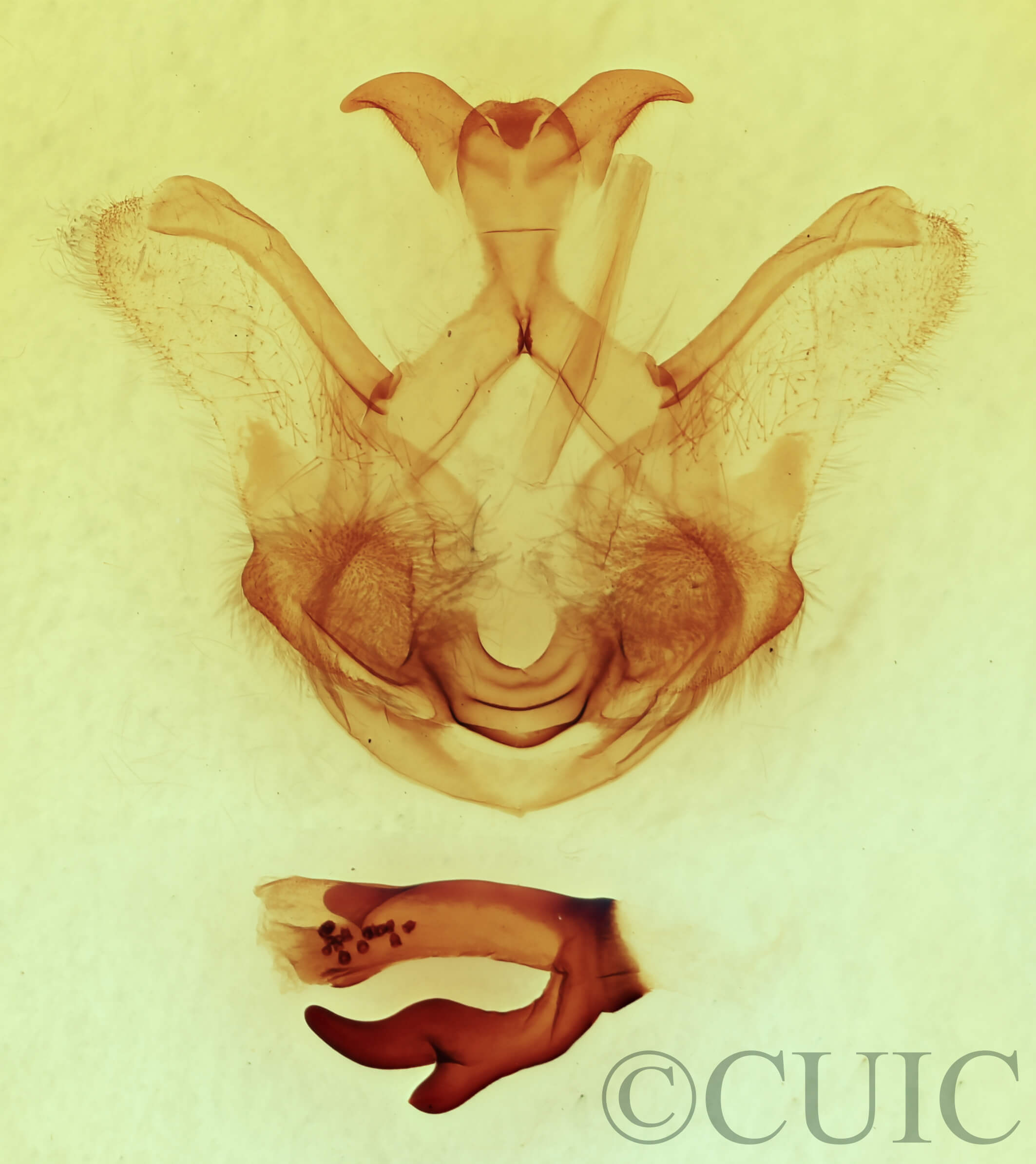 genitalia view of adult Symmerista leucitys