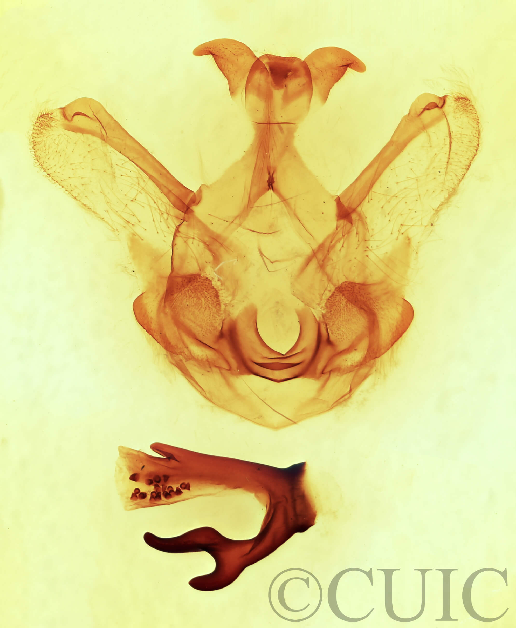 genitalia view of adult Symmerista leucitys