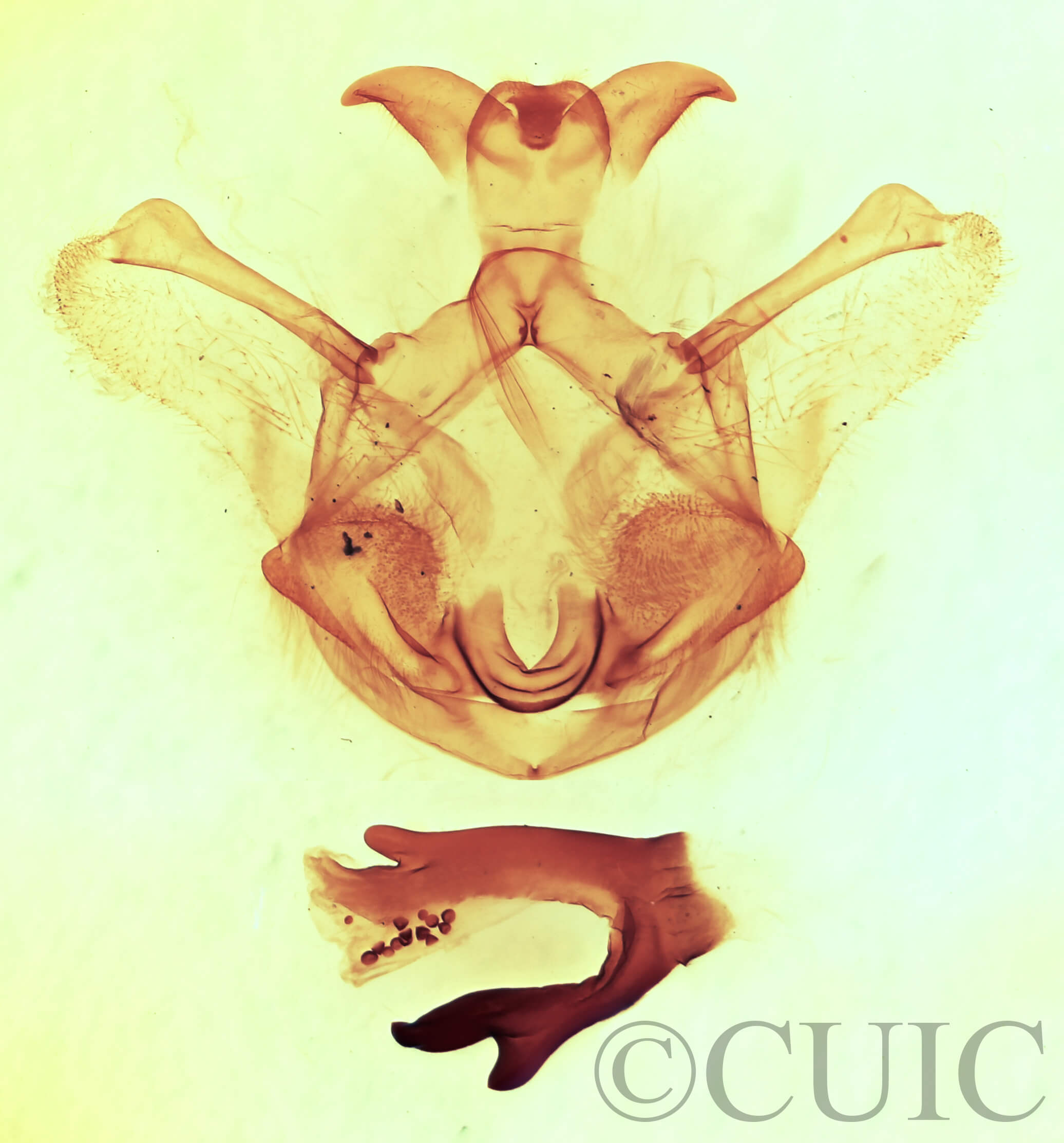 genitalia view of adult Symmerista canicosta