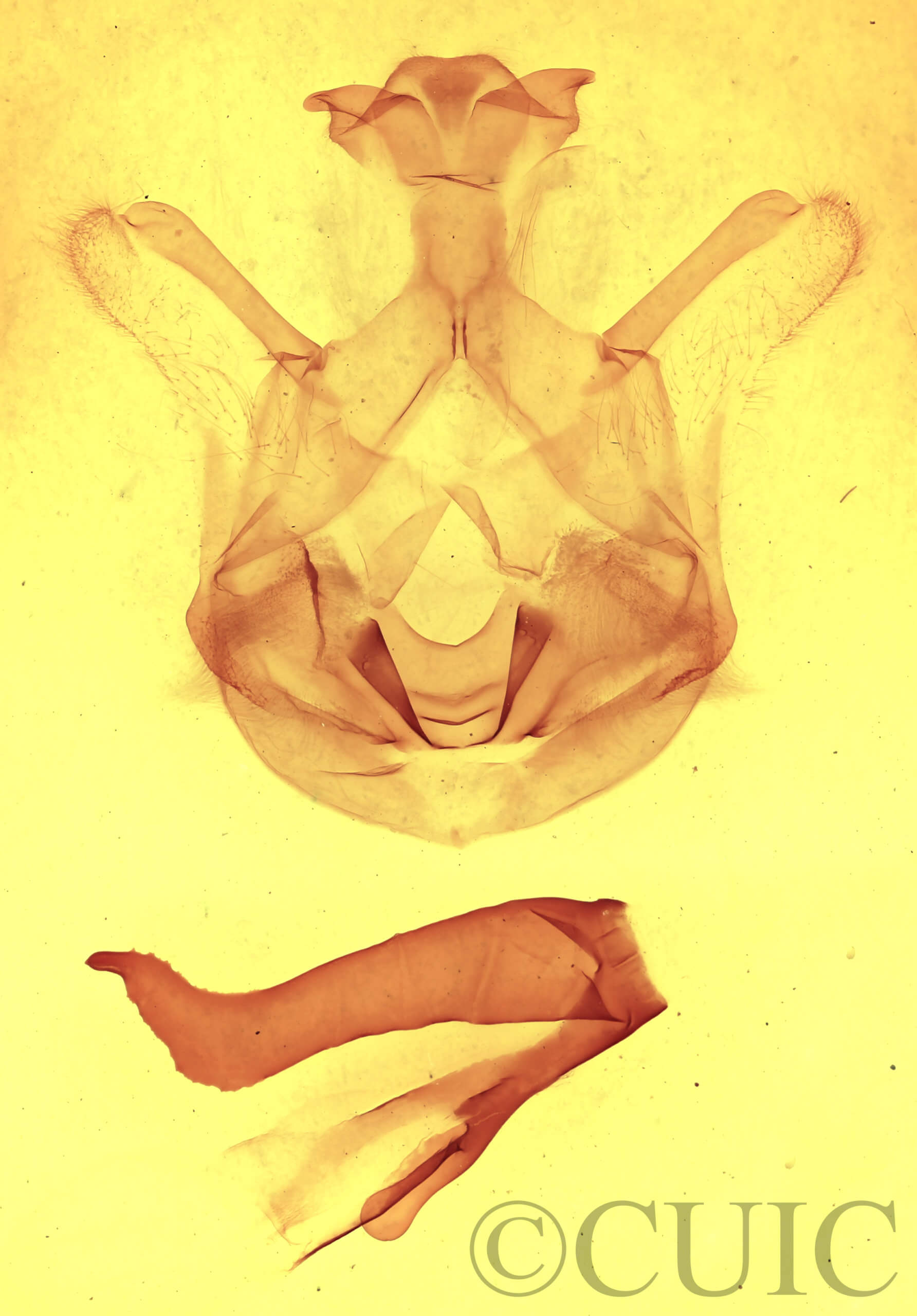 genitalia view of adult Symmerista canicosta