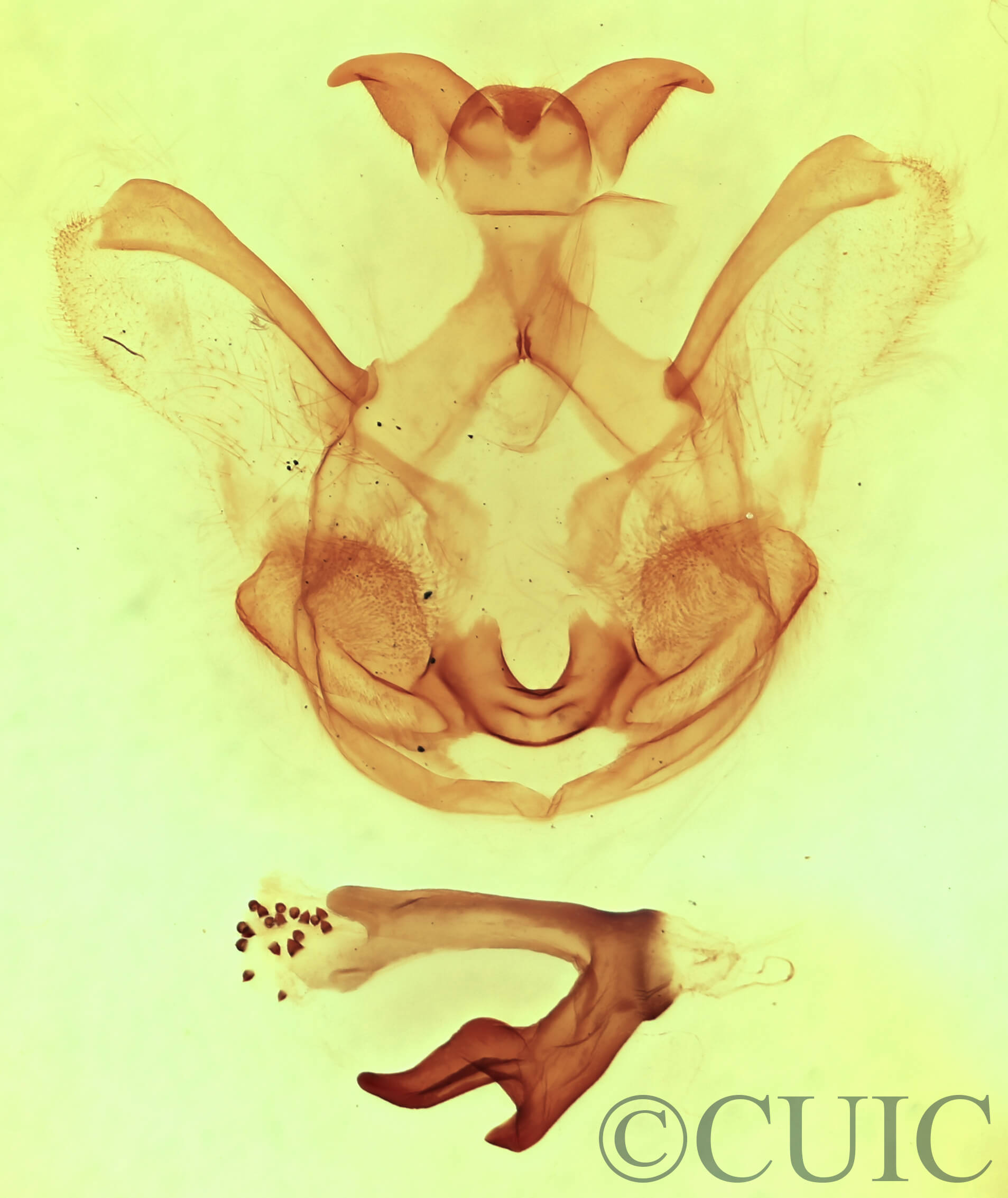 genitalia view of adult Symmerista leucitys