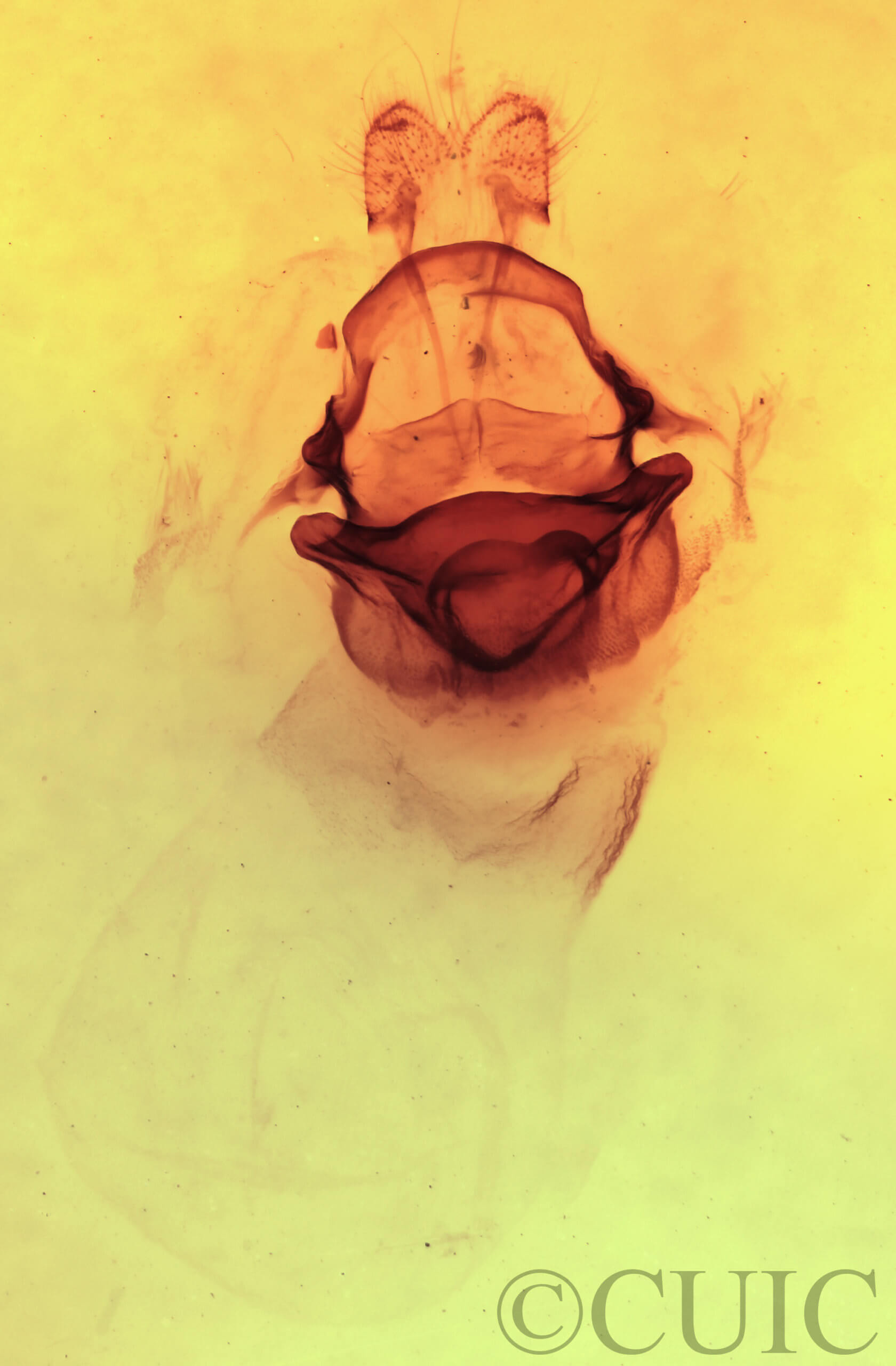 genitalia view of adult Symmerista leucitys