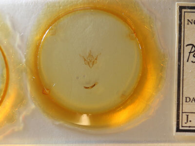 slide view of adult Pseudobryomima