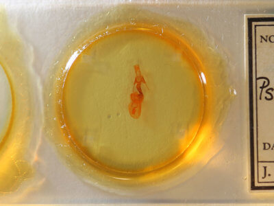 slide view of adult Pseudobryomima