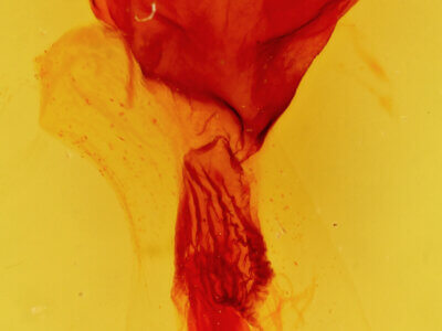 genitalia view of adult Tholera decimalis