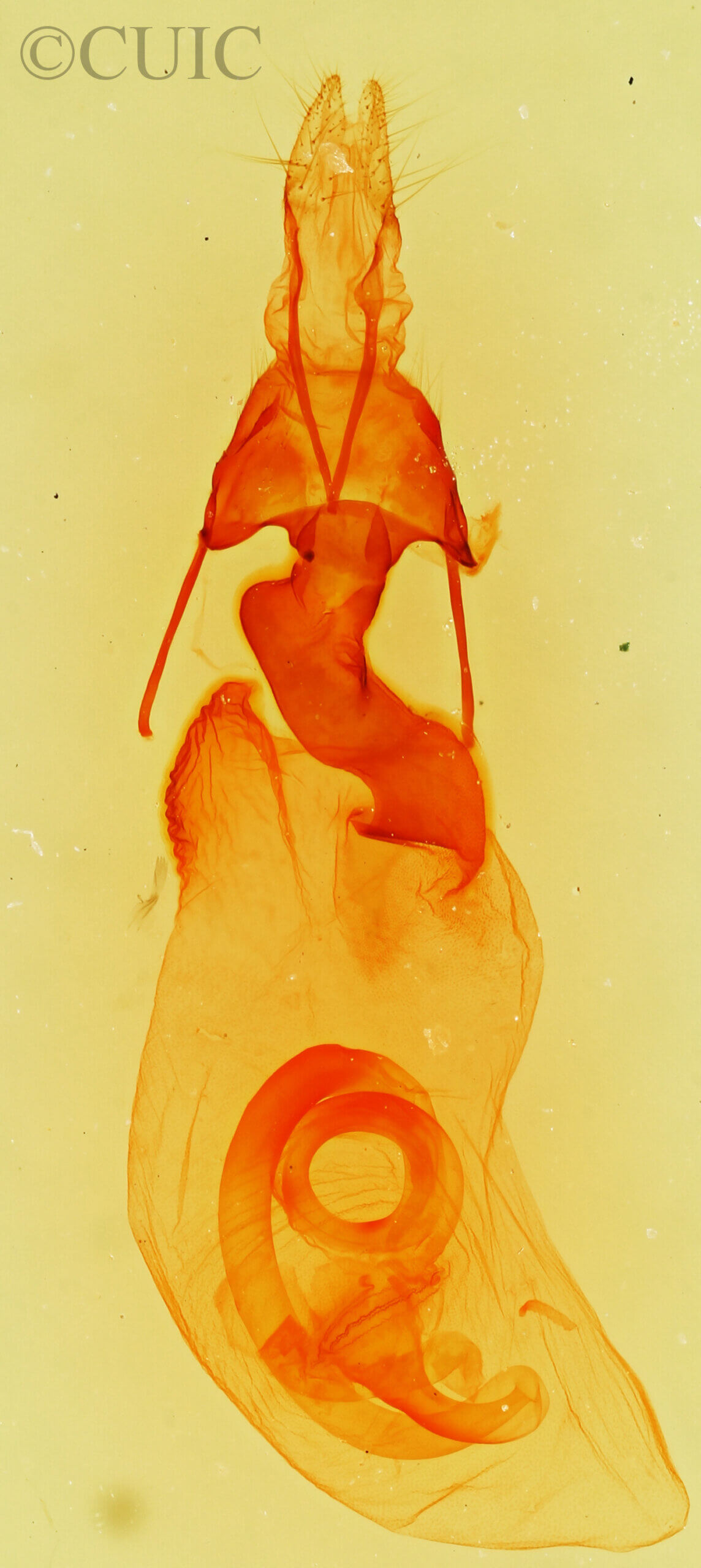 genitalia view of adult Lacinipolia mimula
