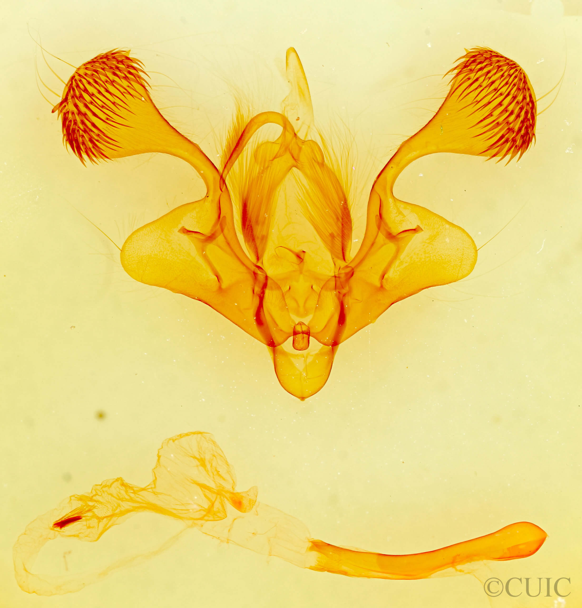 genitalia view of adult Mythimna albiviata