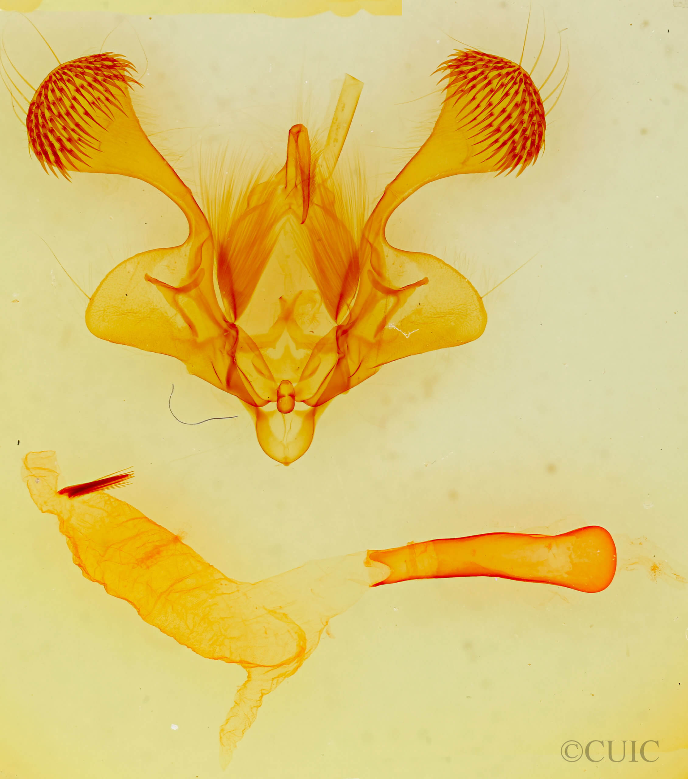 genitalia view of adult Mythimna albiviata