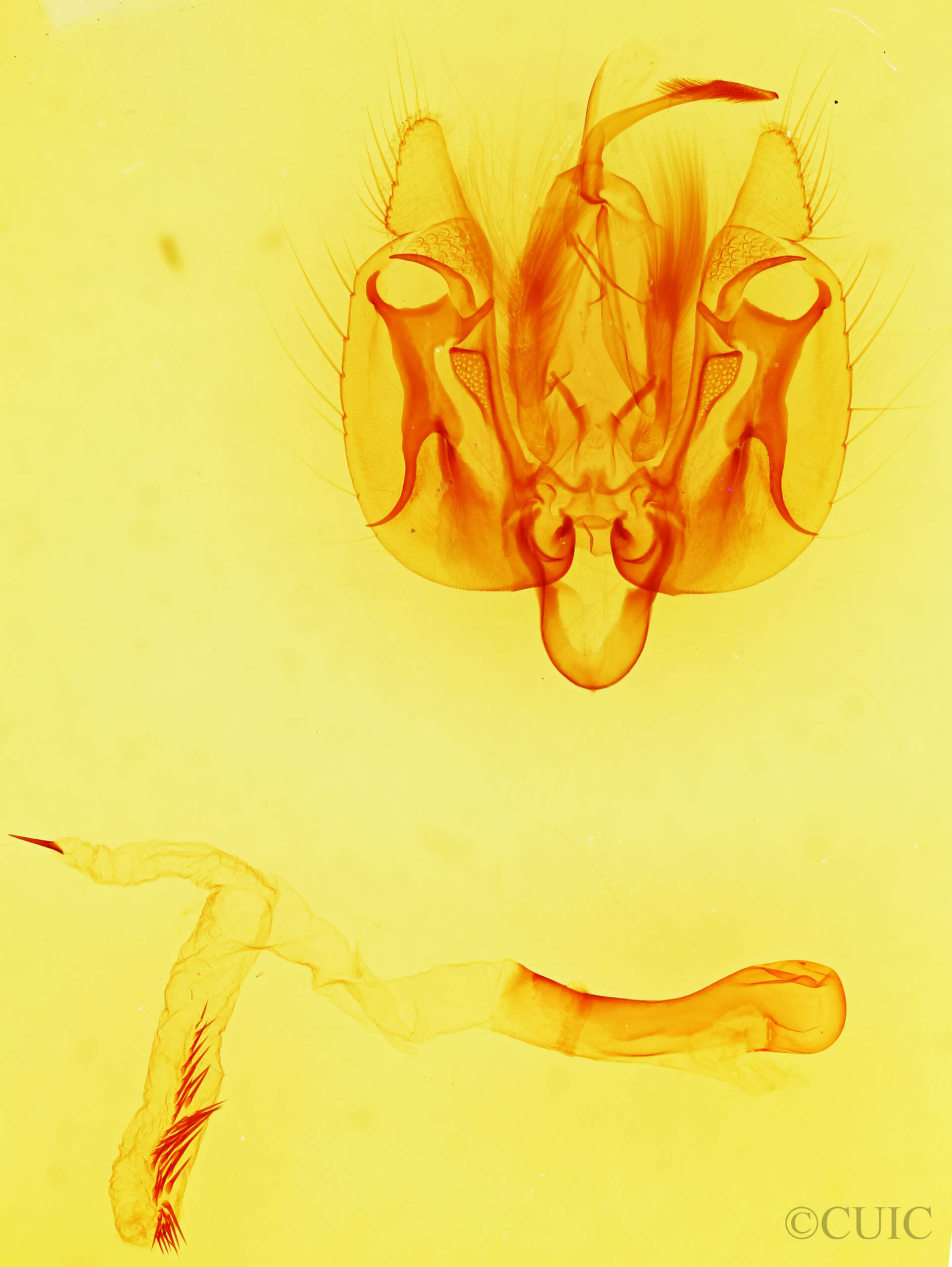 genitalia view of adult Leucania stolata