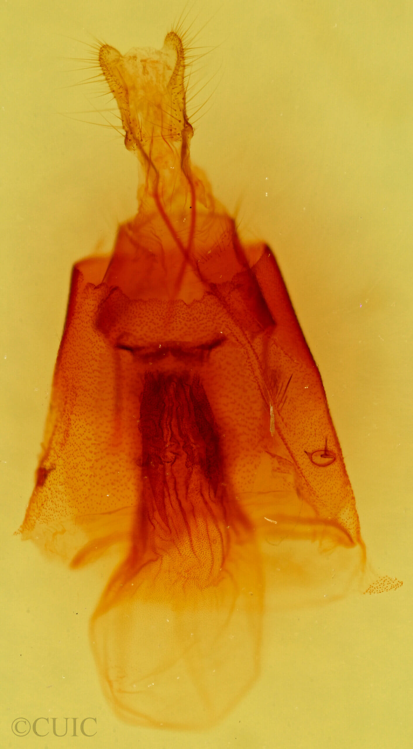 genitalia view of adult Hexorthodes agrotiformis