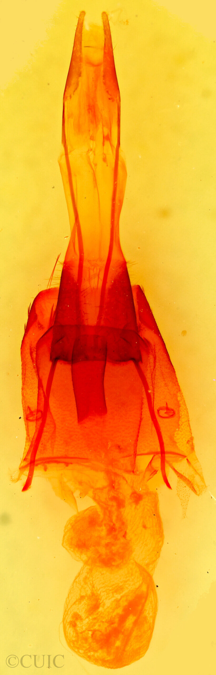 genitalia view of adult Protorthodes ustulata