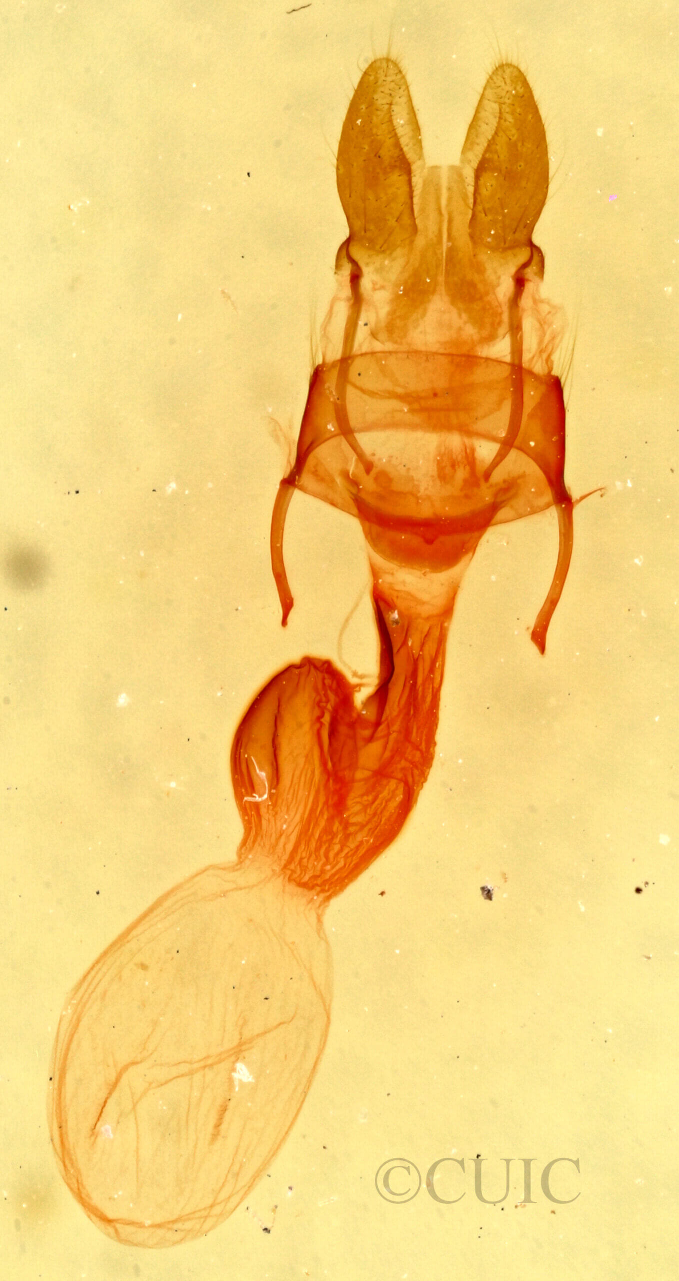 genitalia view of adult Neoligia albirena