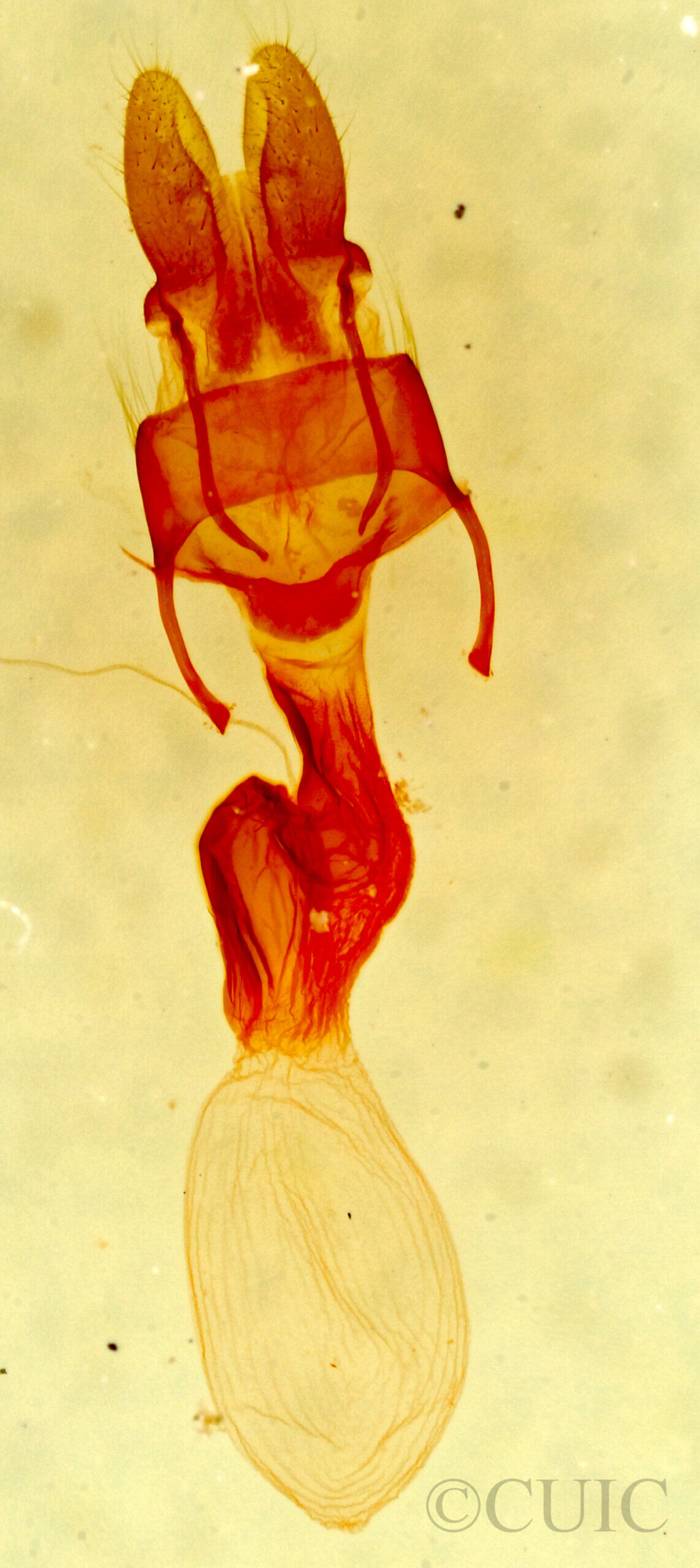 genitalia view of adult Neoligia albirena