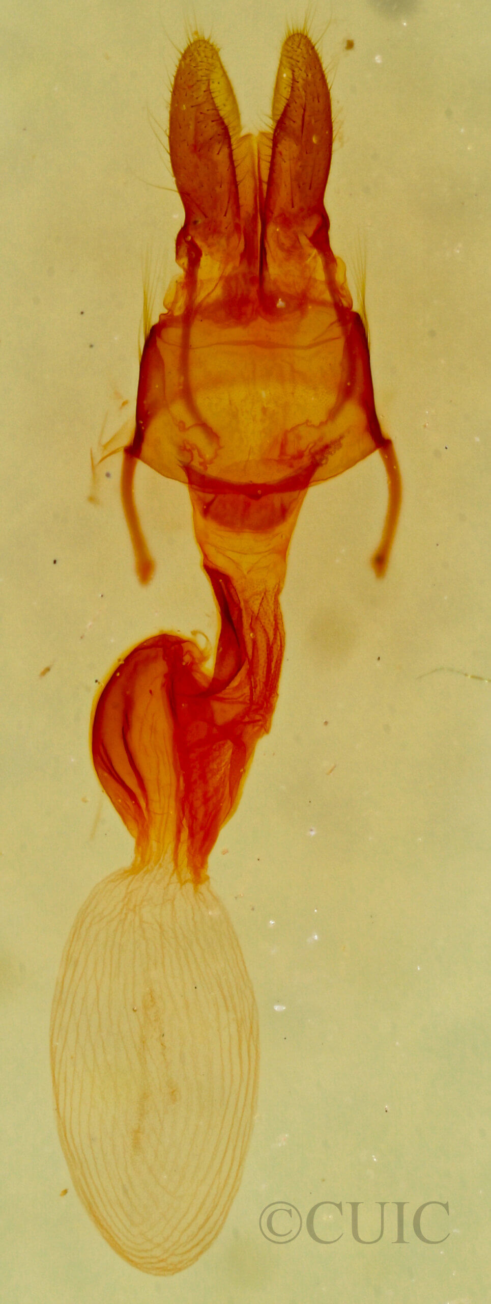 genitalia view of adult Neoligia albirena