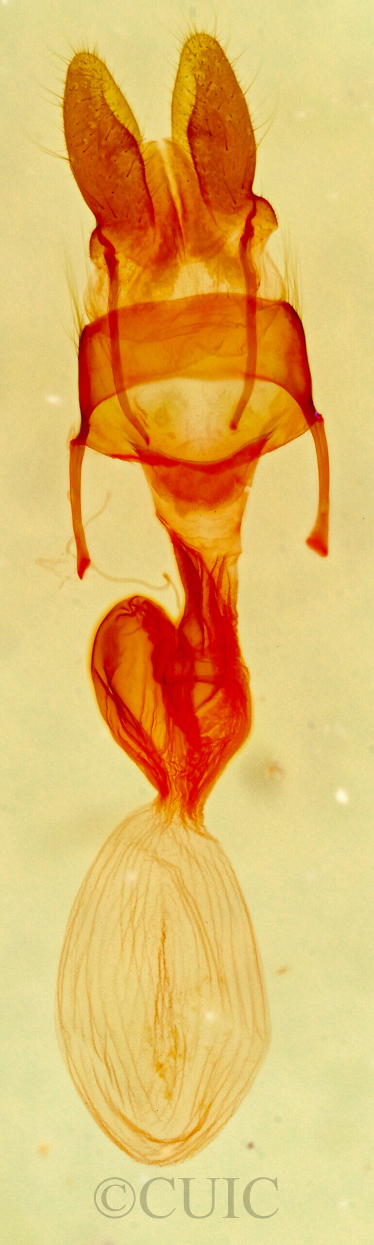 genitalia view of adult Neoligia albirena