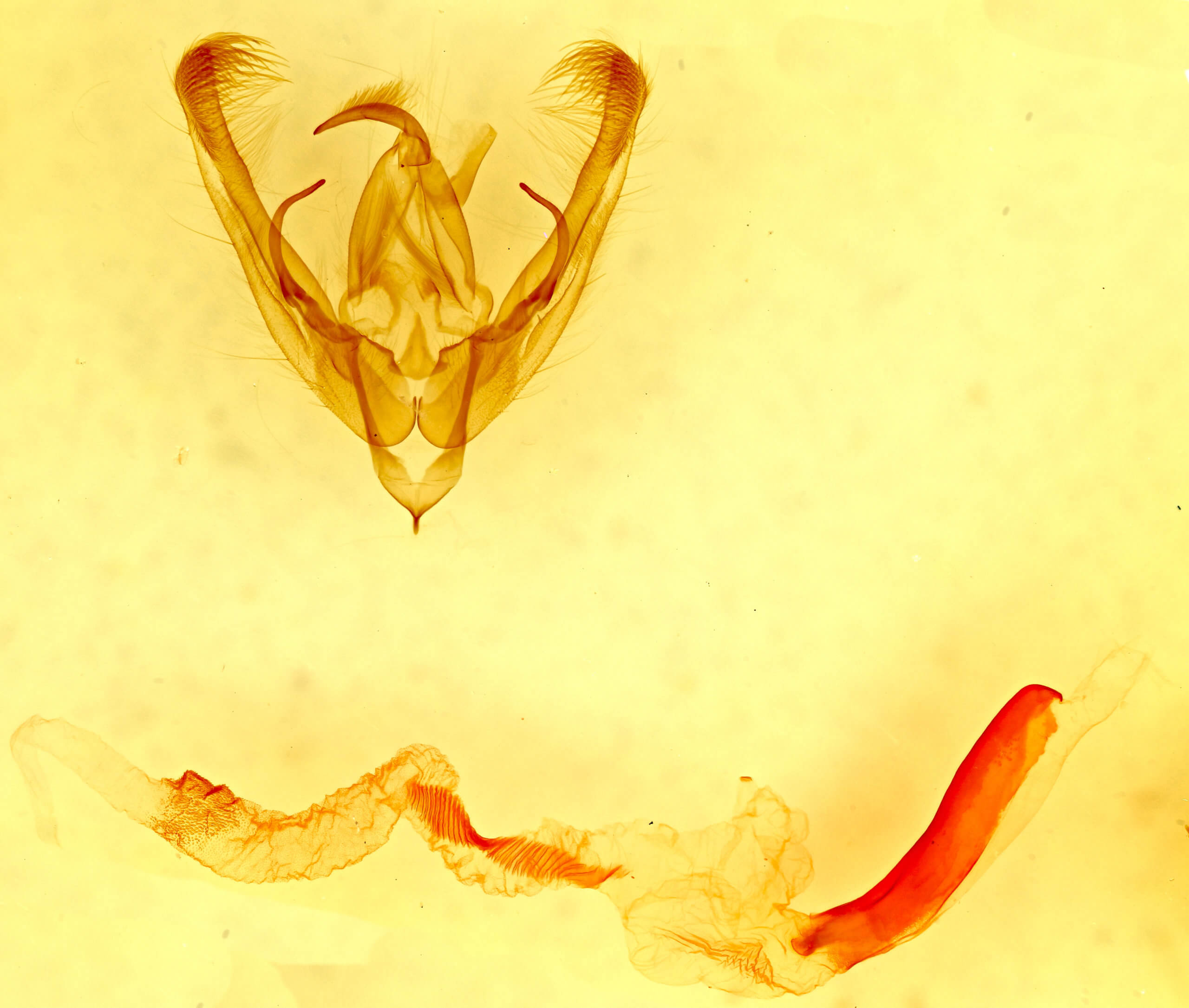 genitalia view of adult Ulolonche sp.