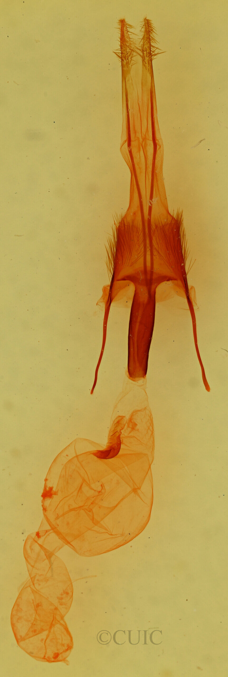 genitalia view of adult Ulolonche dilecta