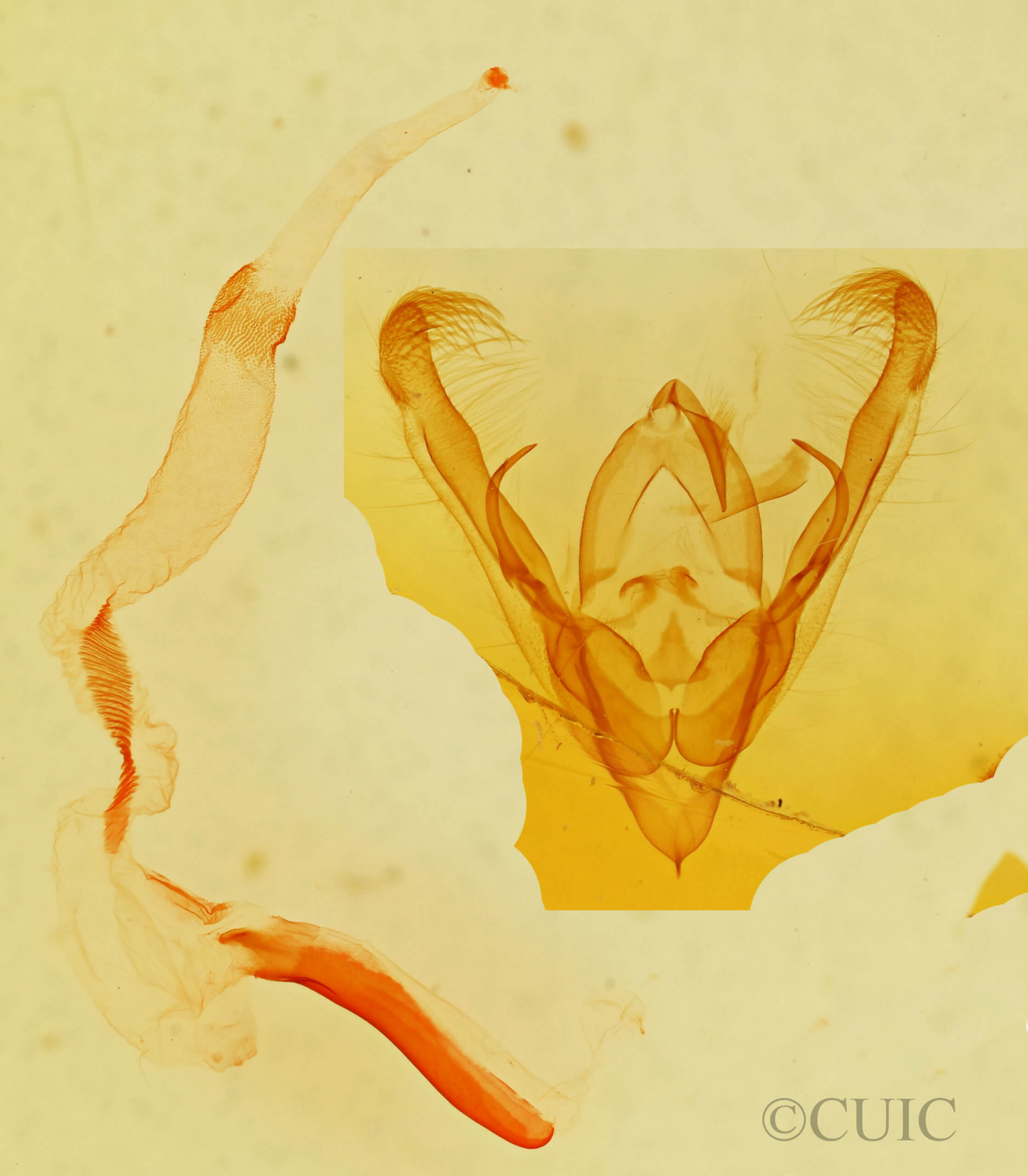 genitalia view of adult Ulolonche fasciata