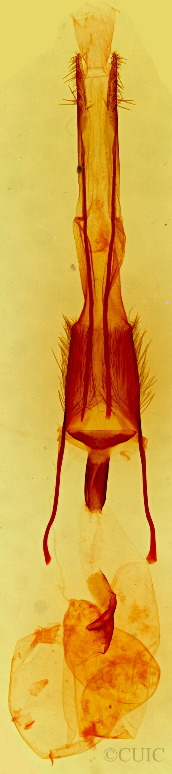 genitalia view of adult Ulolonche fasciata
