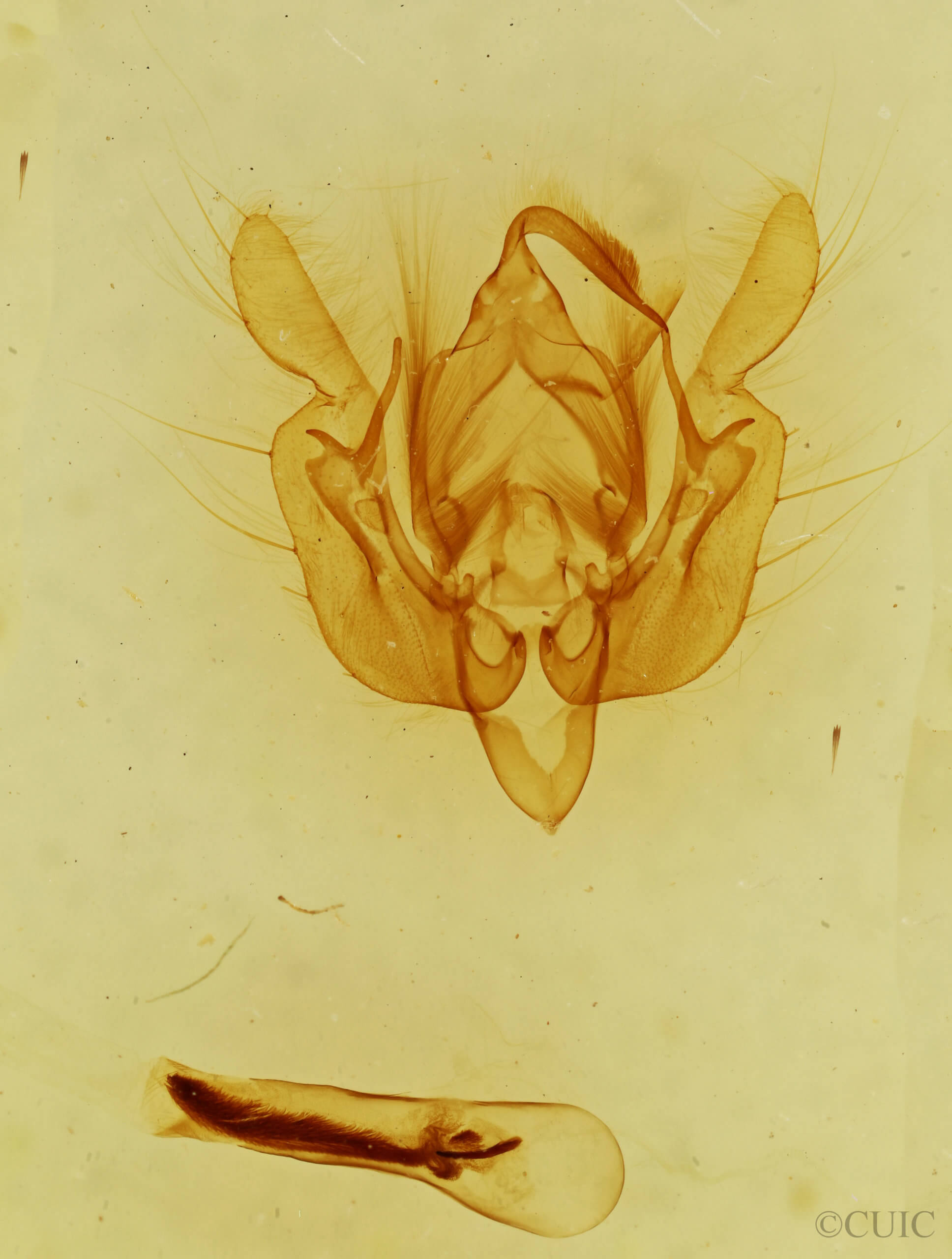 genitalia view of adult Leucania dia