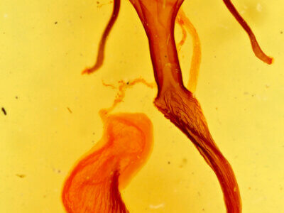 genitalia view of adult Leucania dia