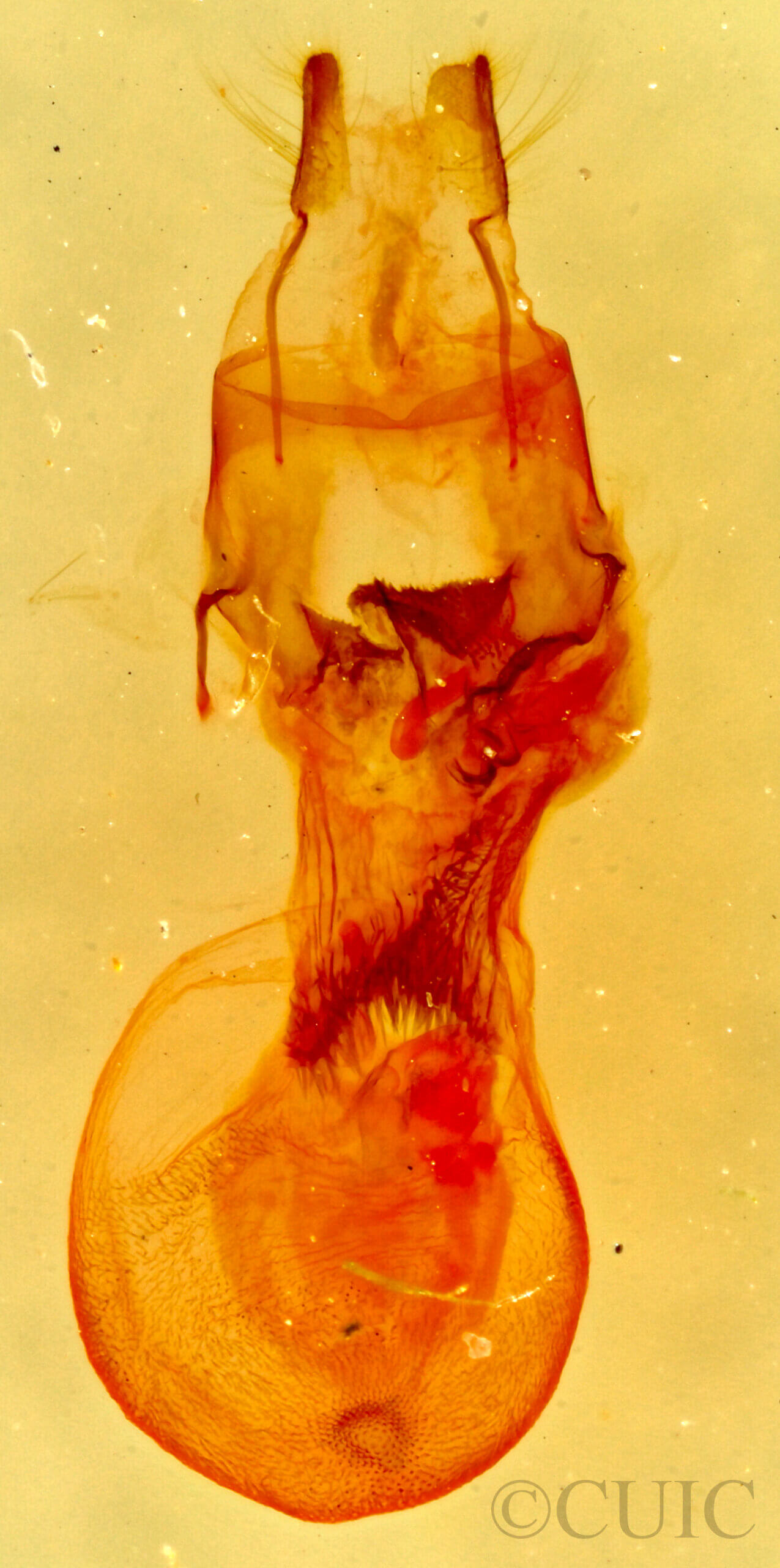 genitalia view of adult Oxycilla tripla
