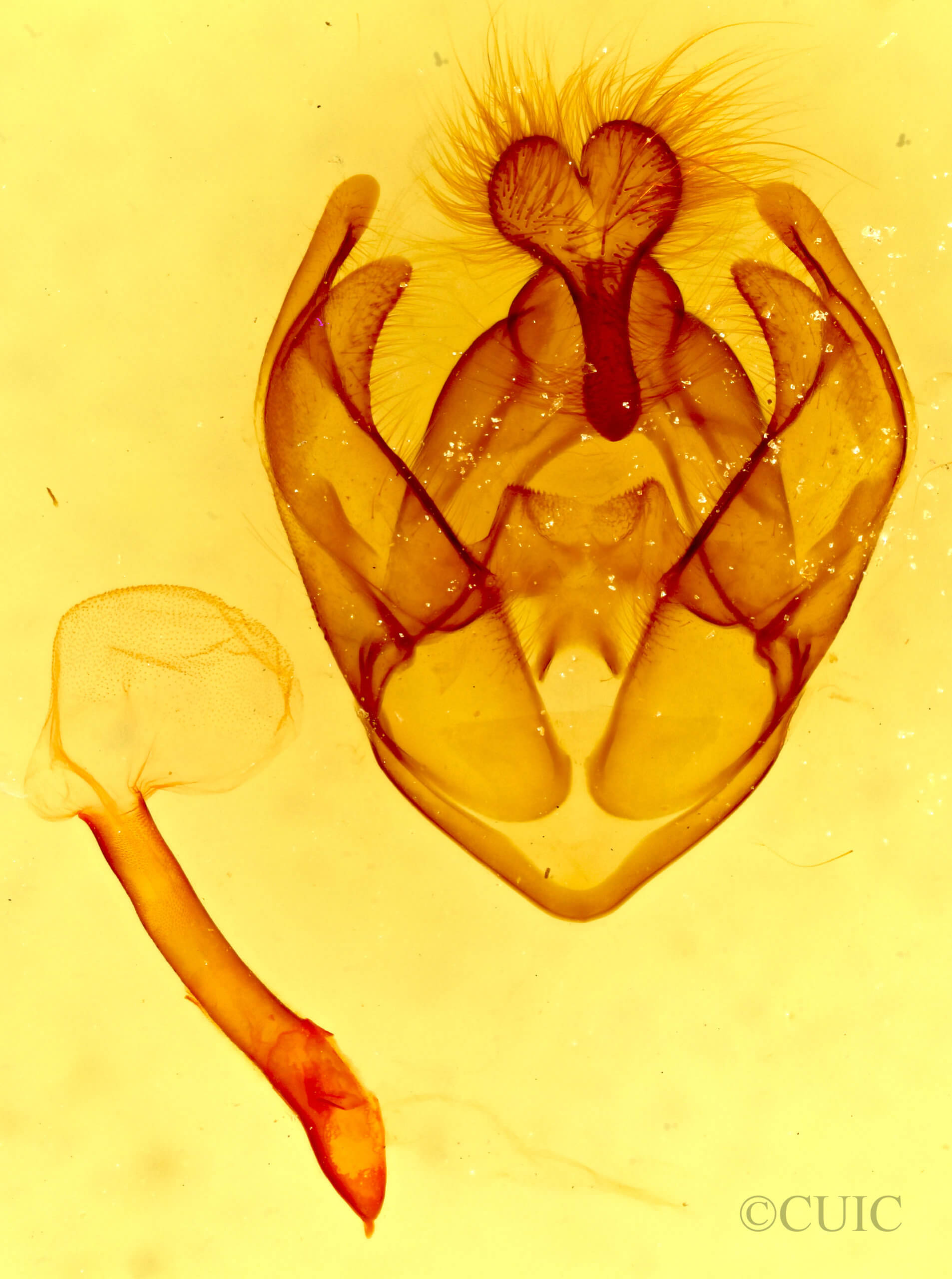 genitalia view of adult Pseudohemihyalea ambigua