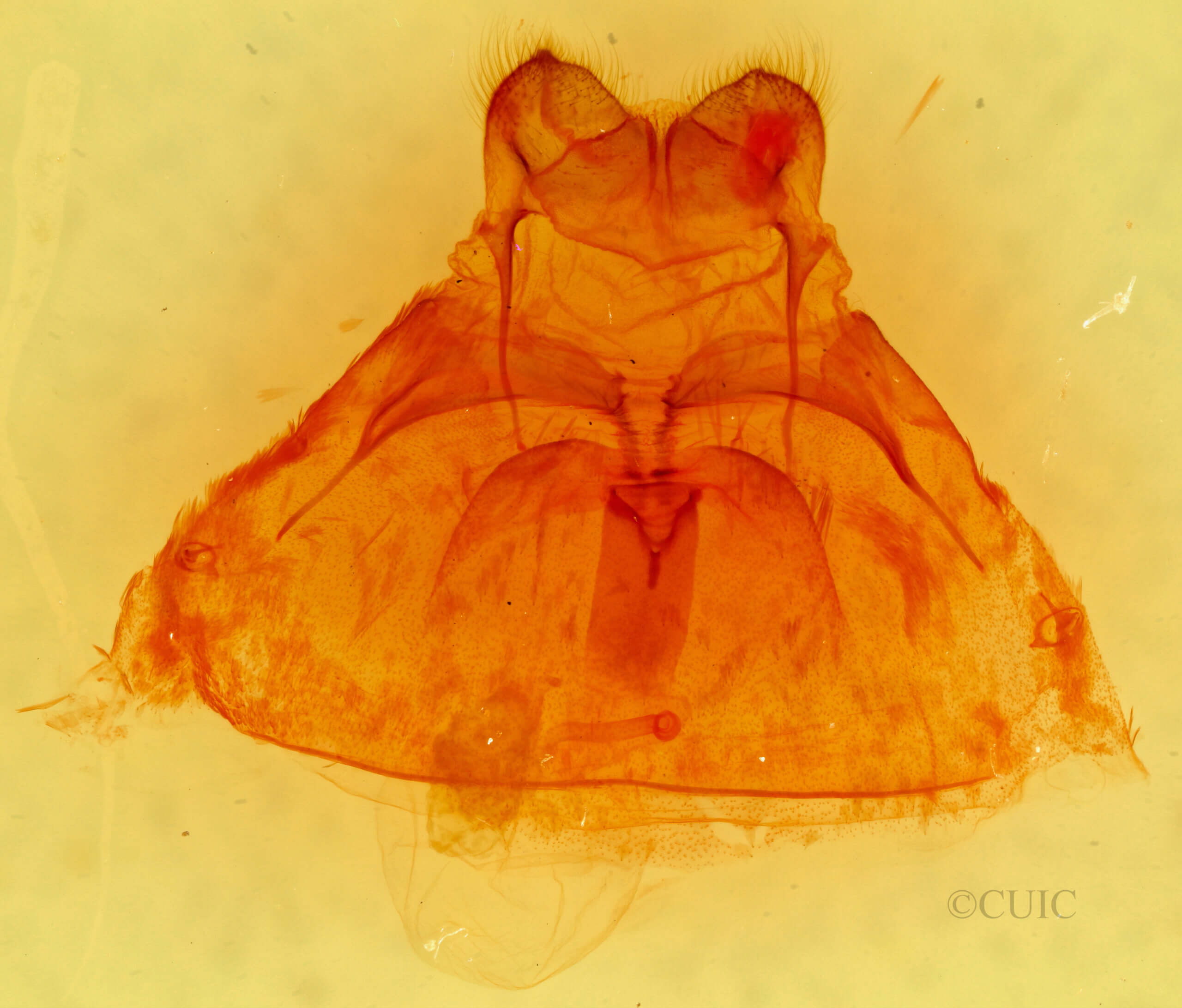 genitalia view of adult Pseudohemihyalea ambigua