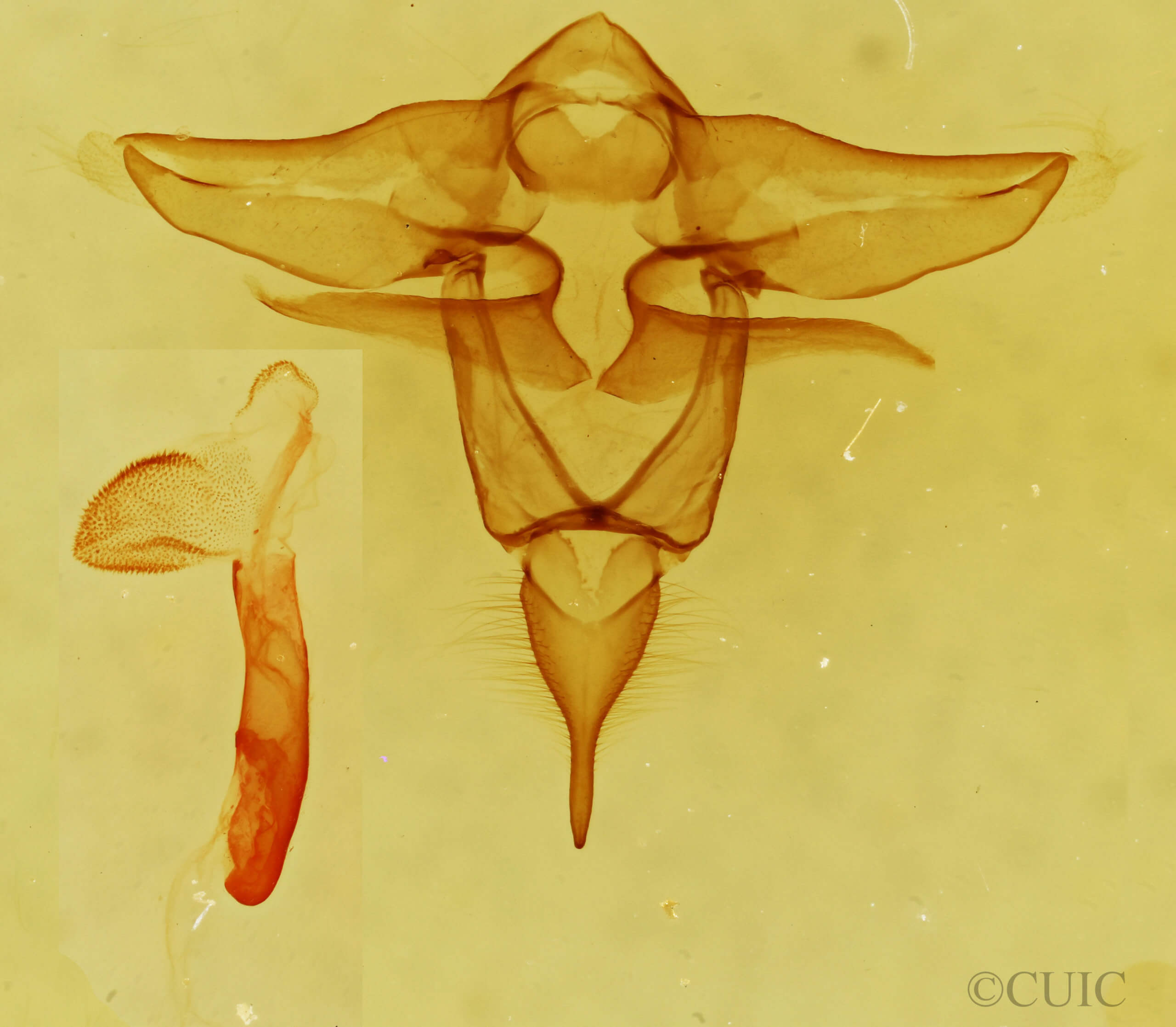 genitalia view of adult Lophocampa roseata