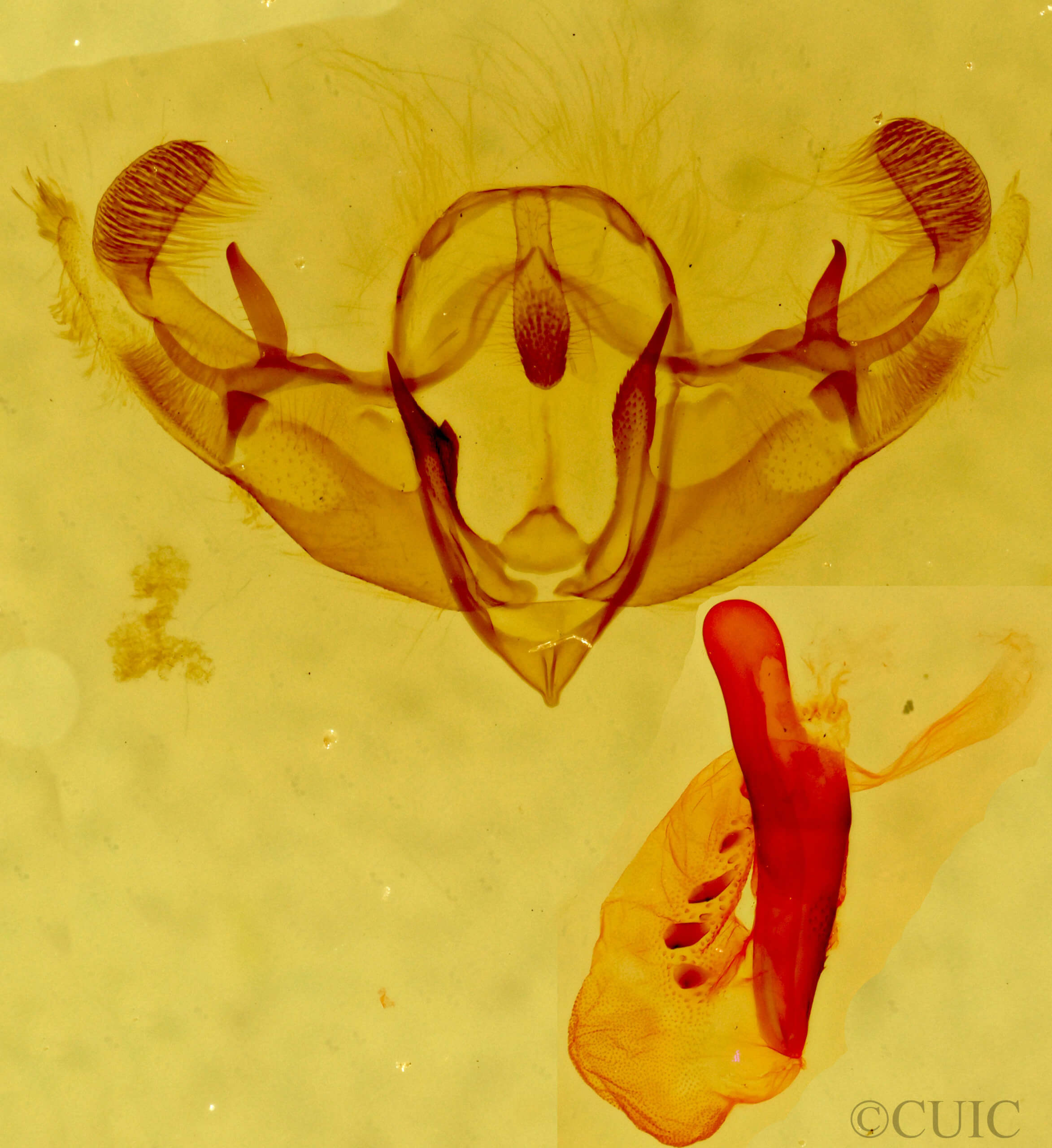 genitalia view of adult Galgula partita